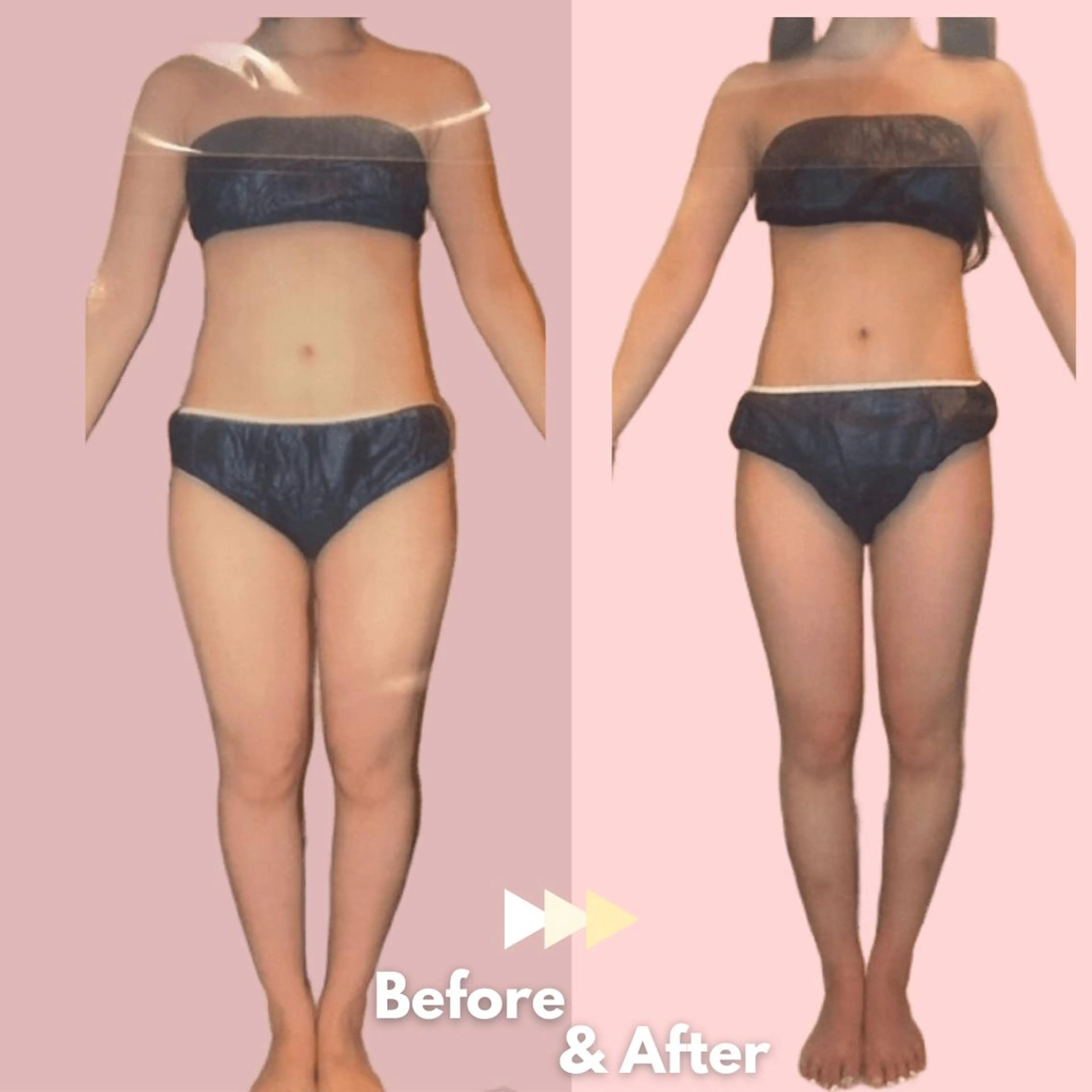 全身痩身✨ キレイサローネ池袋のエステ・リラクイメージ