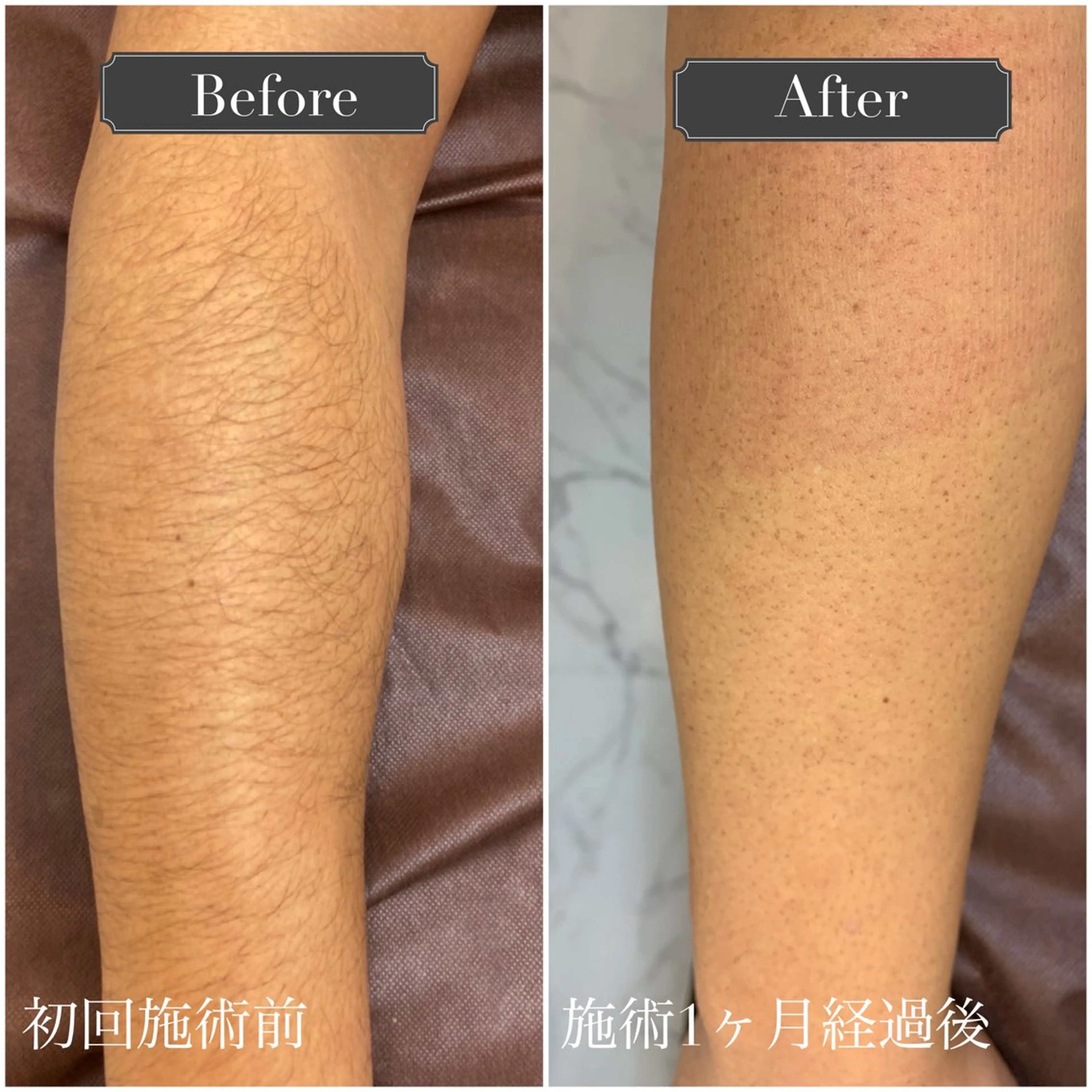 プライベートサロン リプレイスのエステ・リラクイメージ