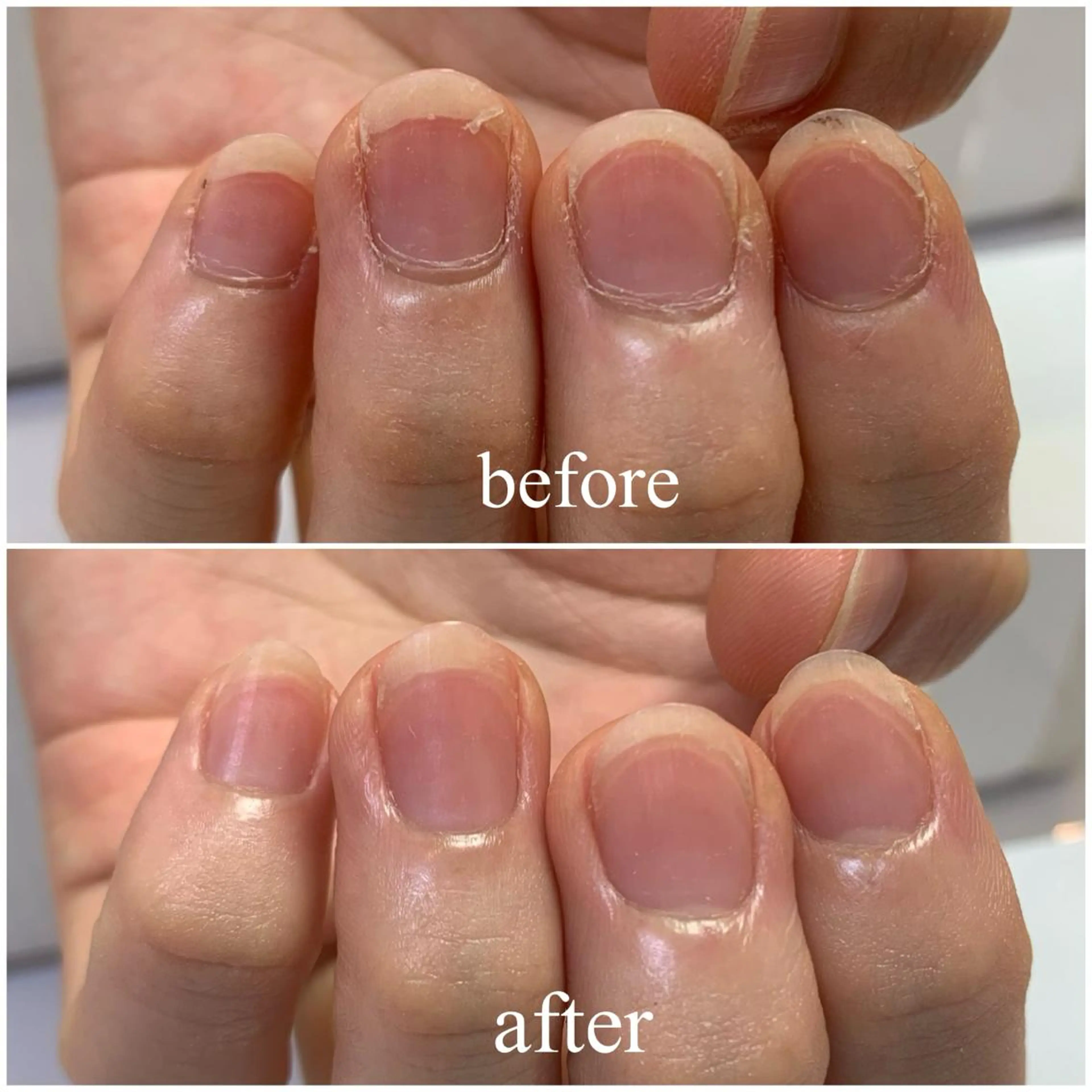 12月限定☆Jrネイリスト☆ジェルオフ無し【育爪コース】贅沢甘皮ケア・クリアベースコート¥2,530→¥2,200の写真