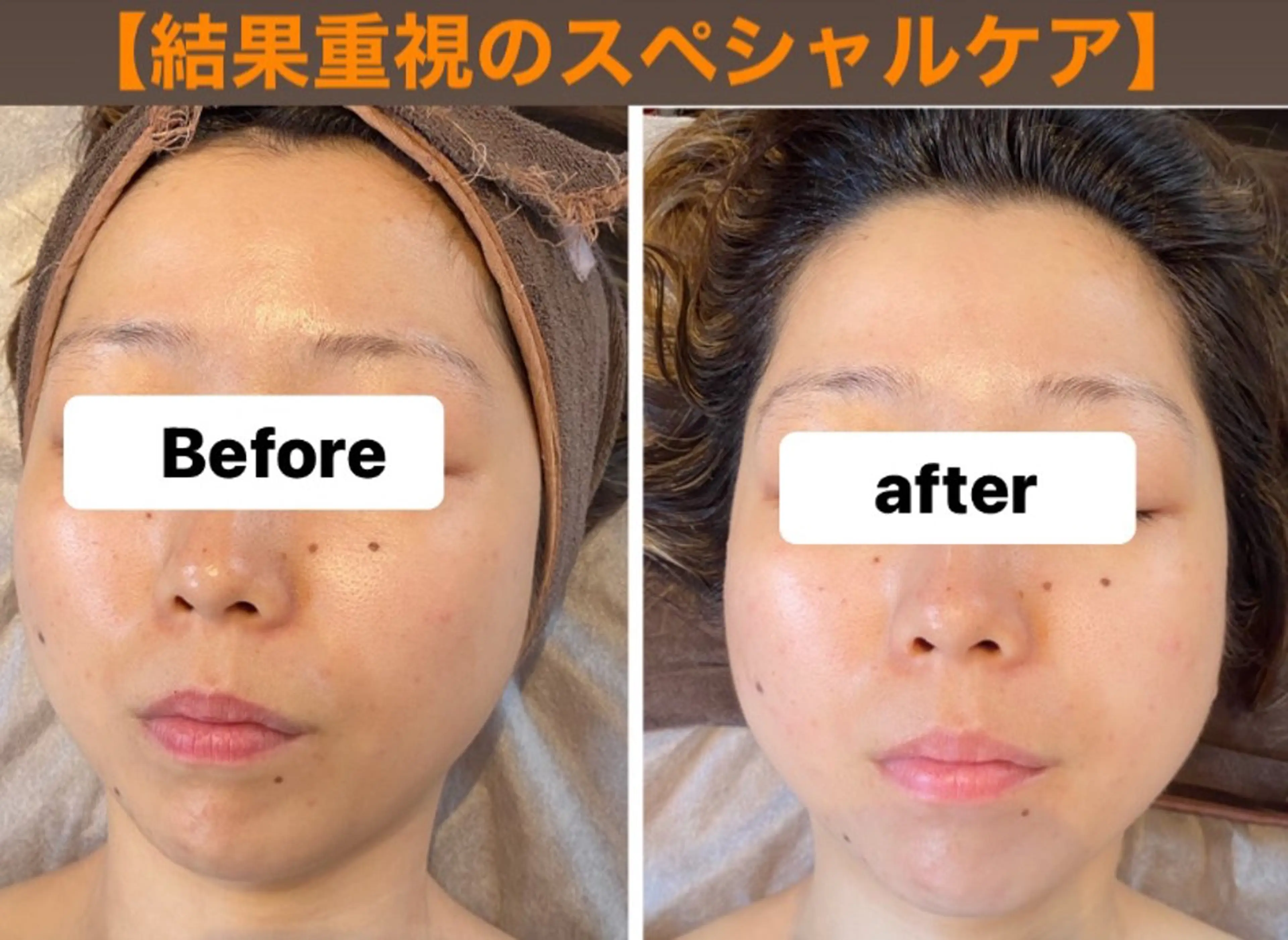 脱毛・エステサロン LuLuNのエステ・リラクイメージ