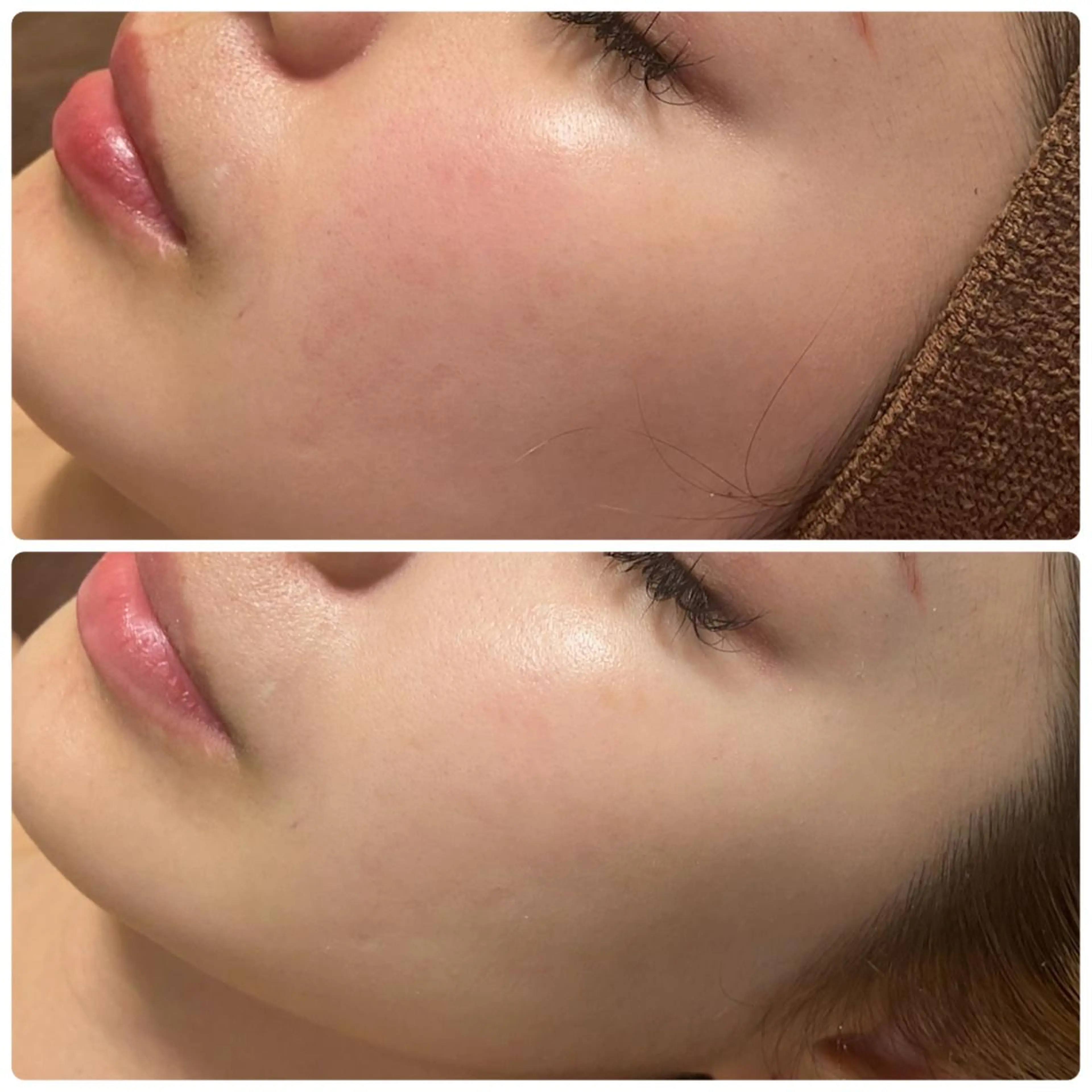 BeSkin藤沢店所属・ニキビ/肌質改善 BeSkin 藤沢店のエステ・リラクイメージ