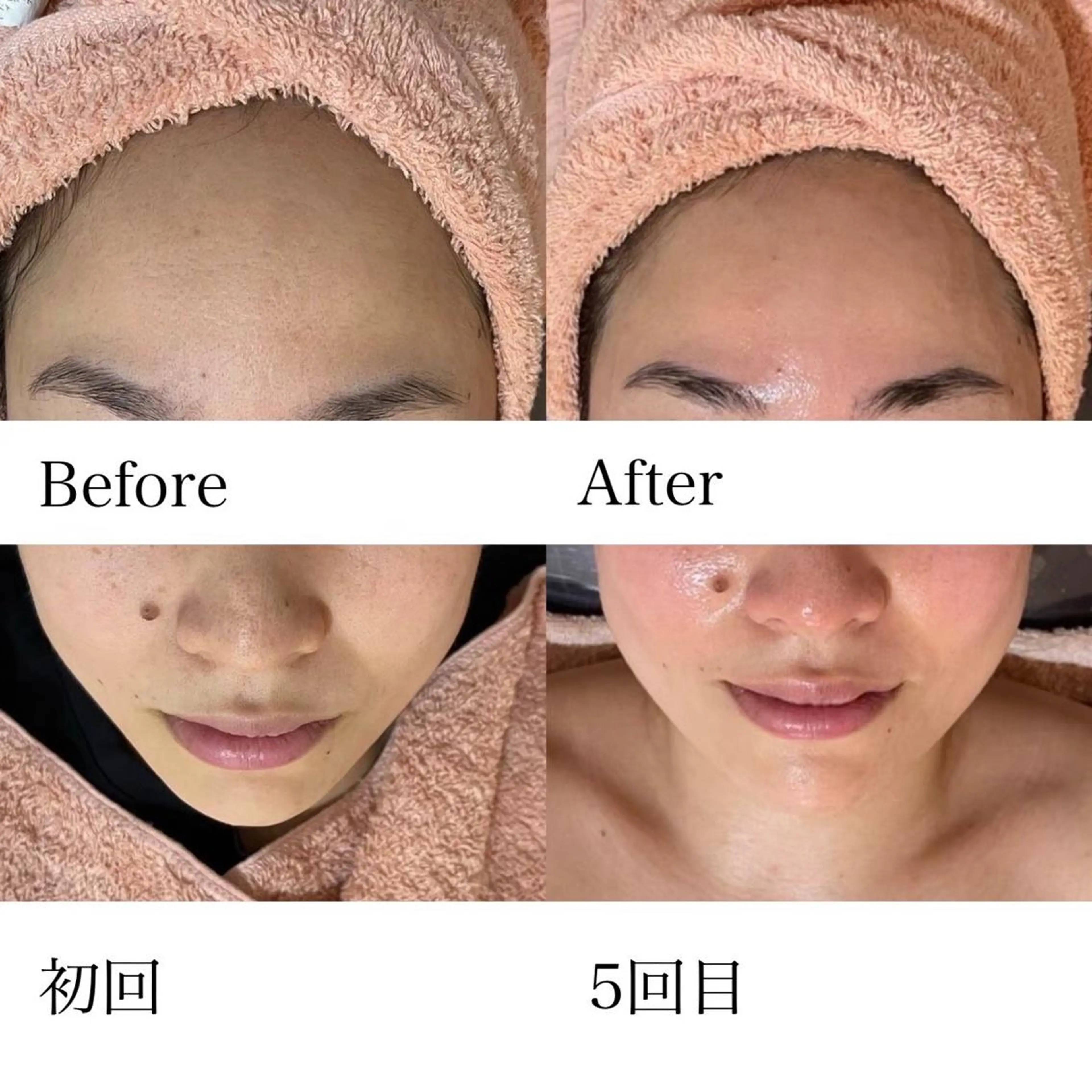 N eye beauty 高丘店所属・N  eye beauty高丘のマツエク・マツパデザイン