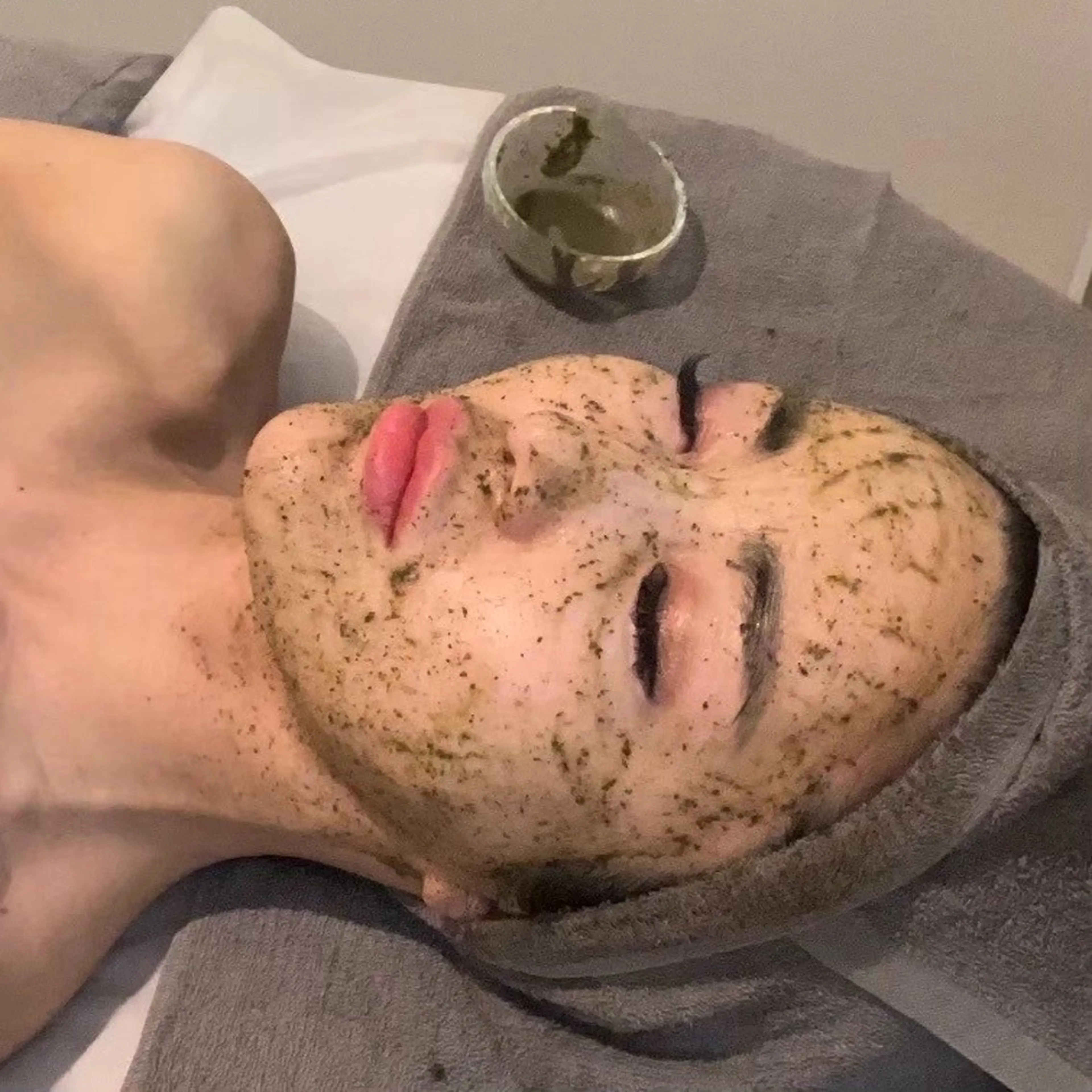 美肌質改善【毛穴・しみ・ニキビケア】剥けないハーブピーリング　★￥11000→￥5,500の写真