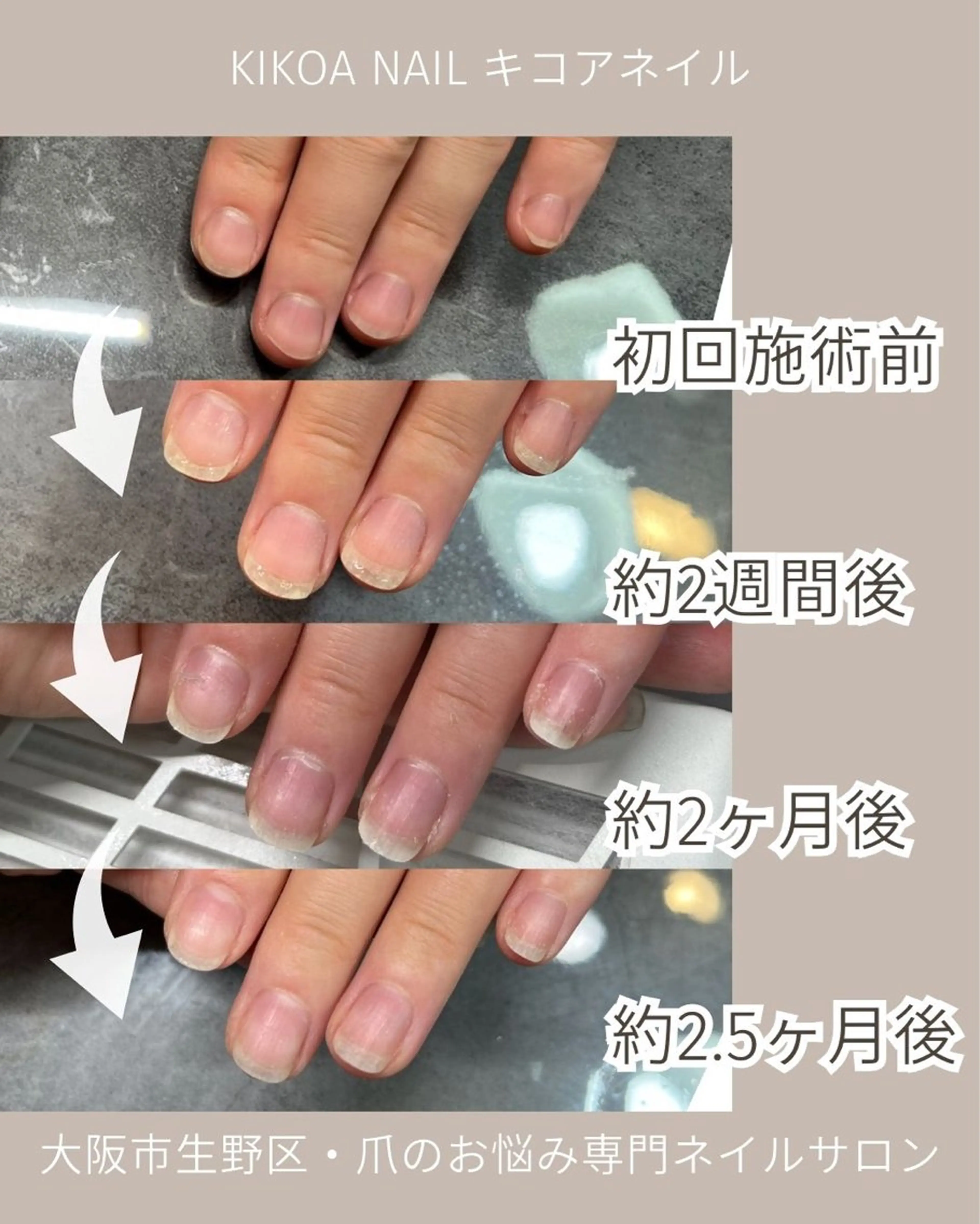 ネイル KIKOA NAIL キコアネイルのネイルデザイン