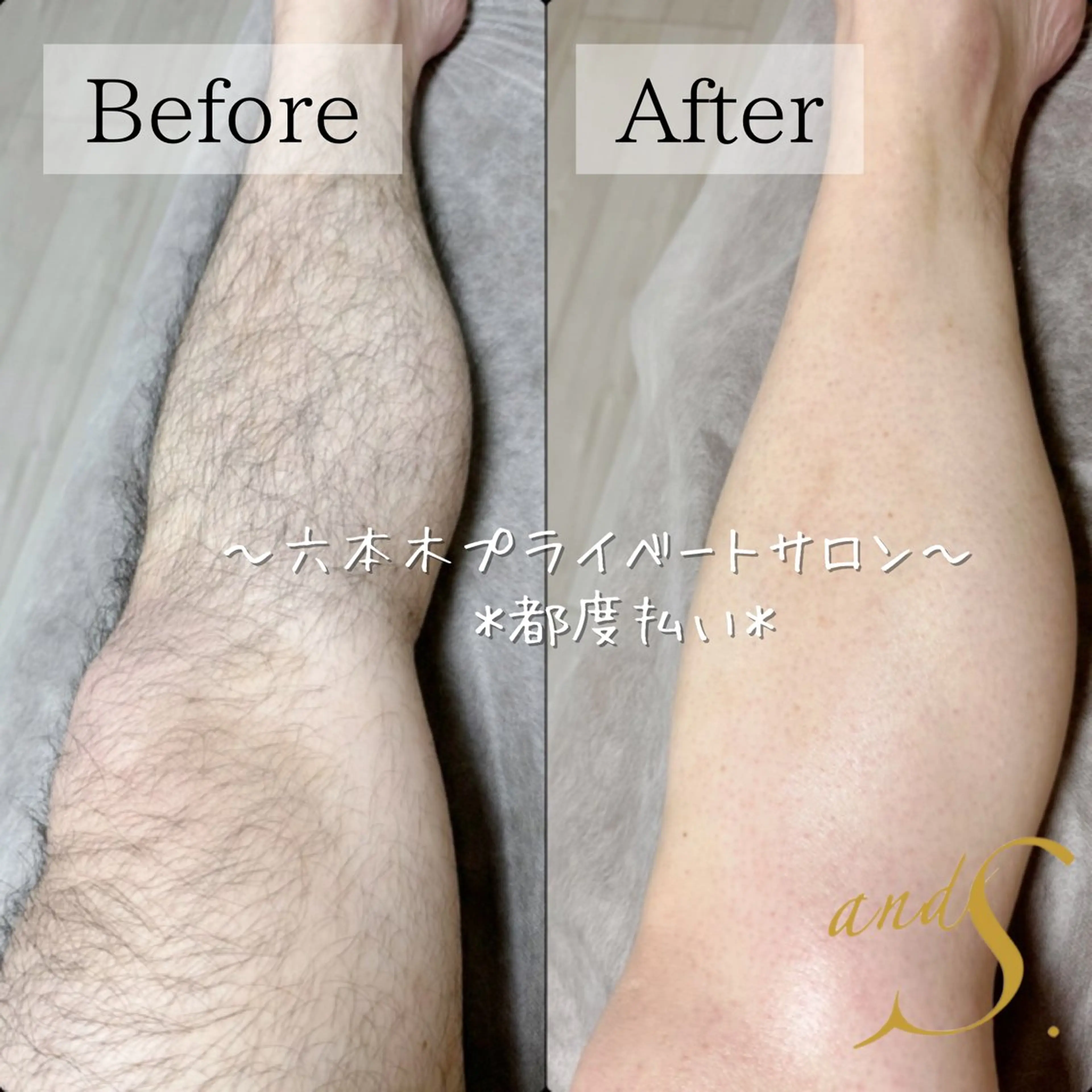 メンズ 脱毛 🌸🧡六本木 脱毛しずか🧡🫧の眉毛・アイブロウイメージ