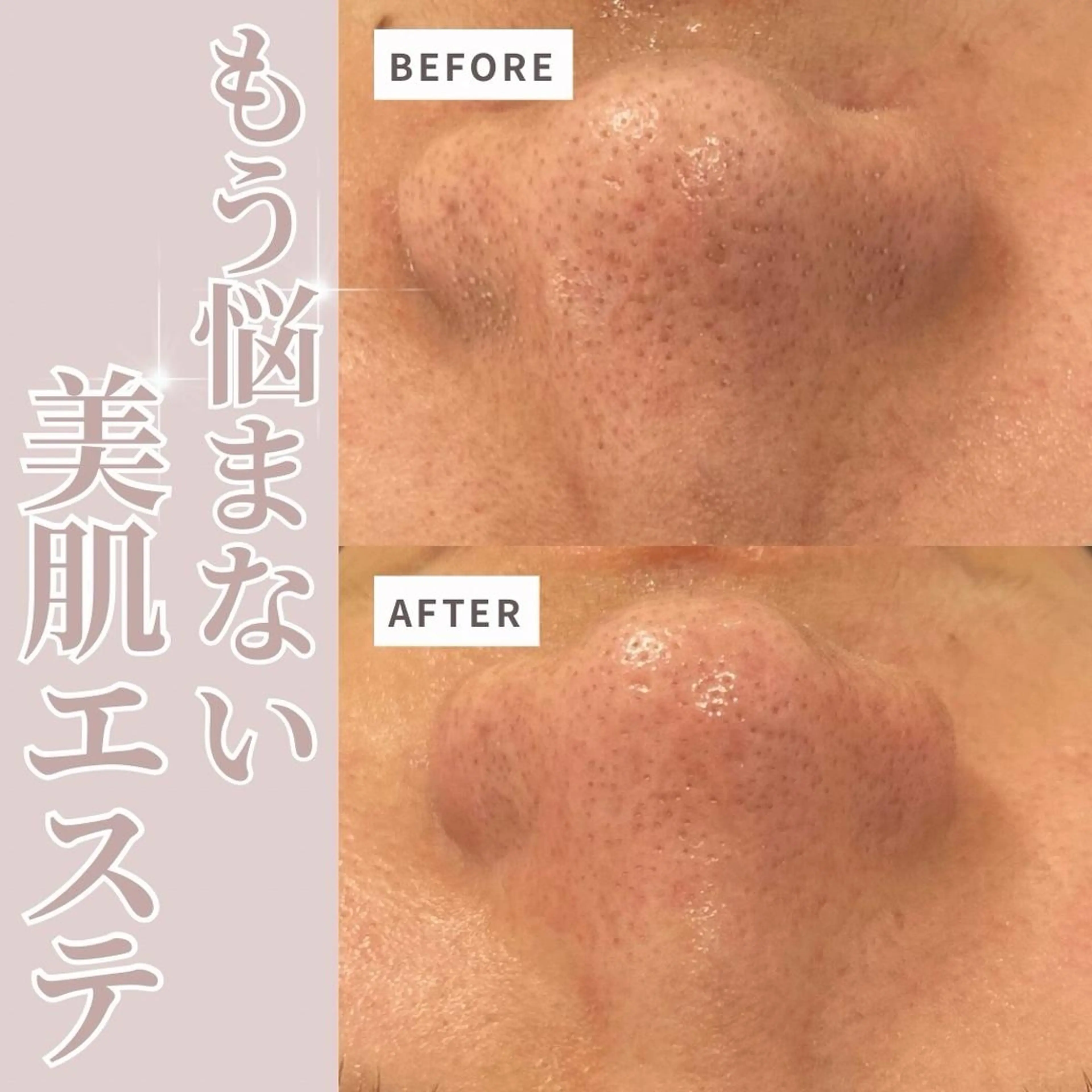 💚THE BALM 金子💚✨のエステ・リラクイメージ