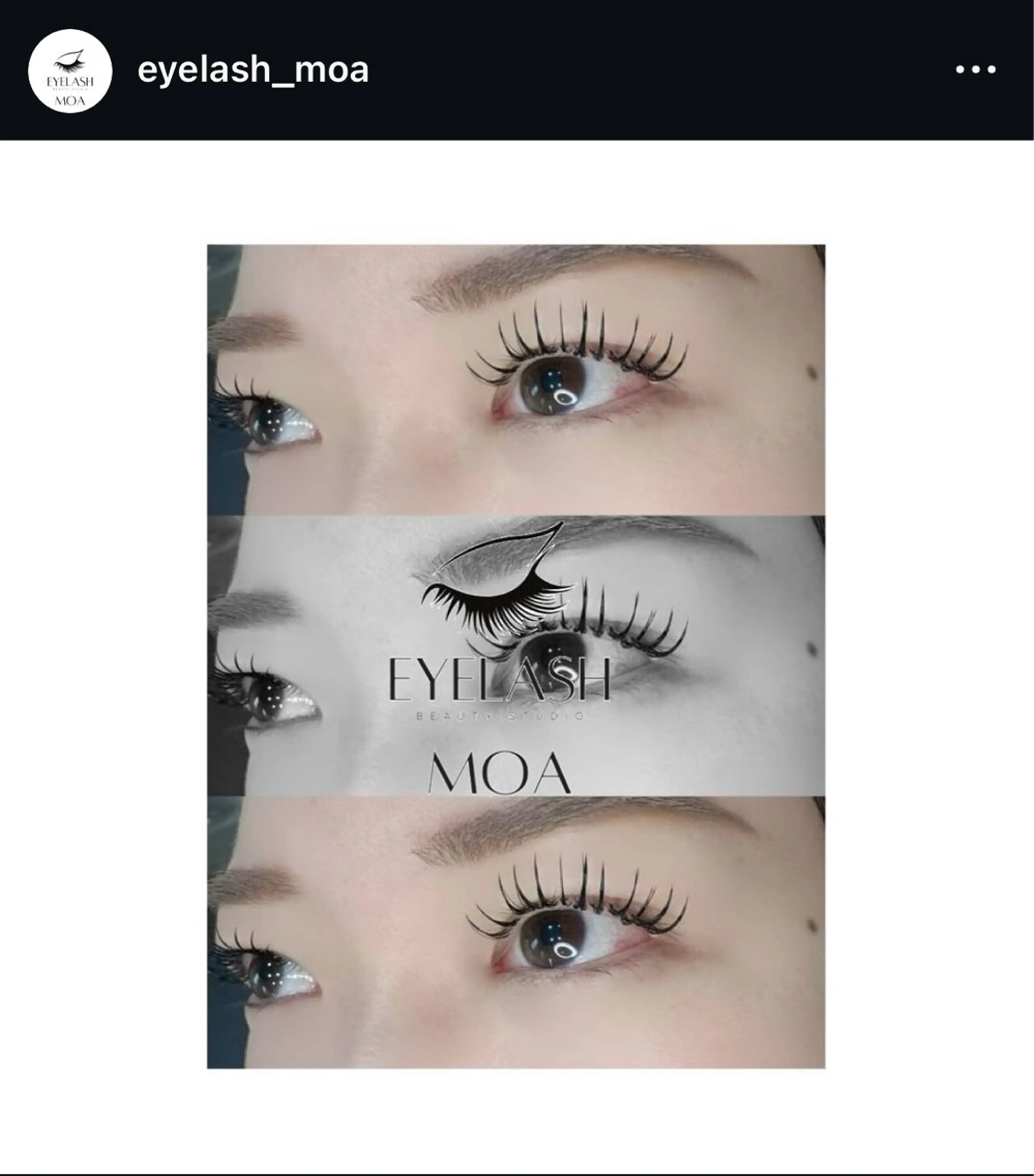 フラットラッシュ:（両目）140本の写真