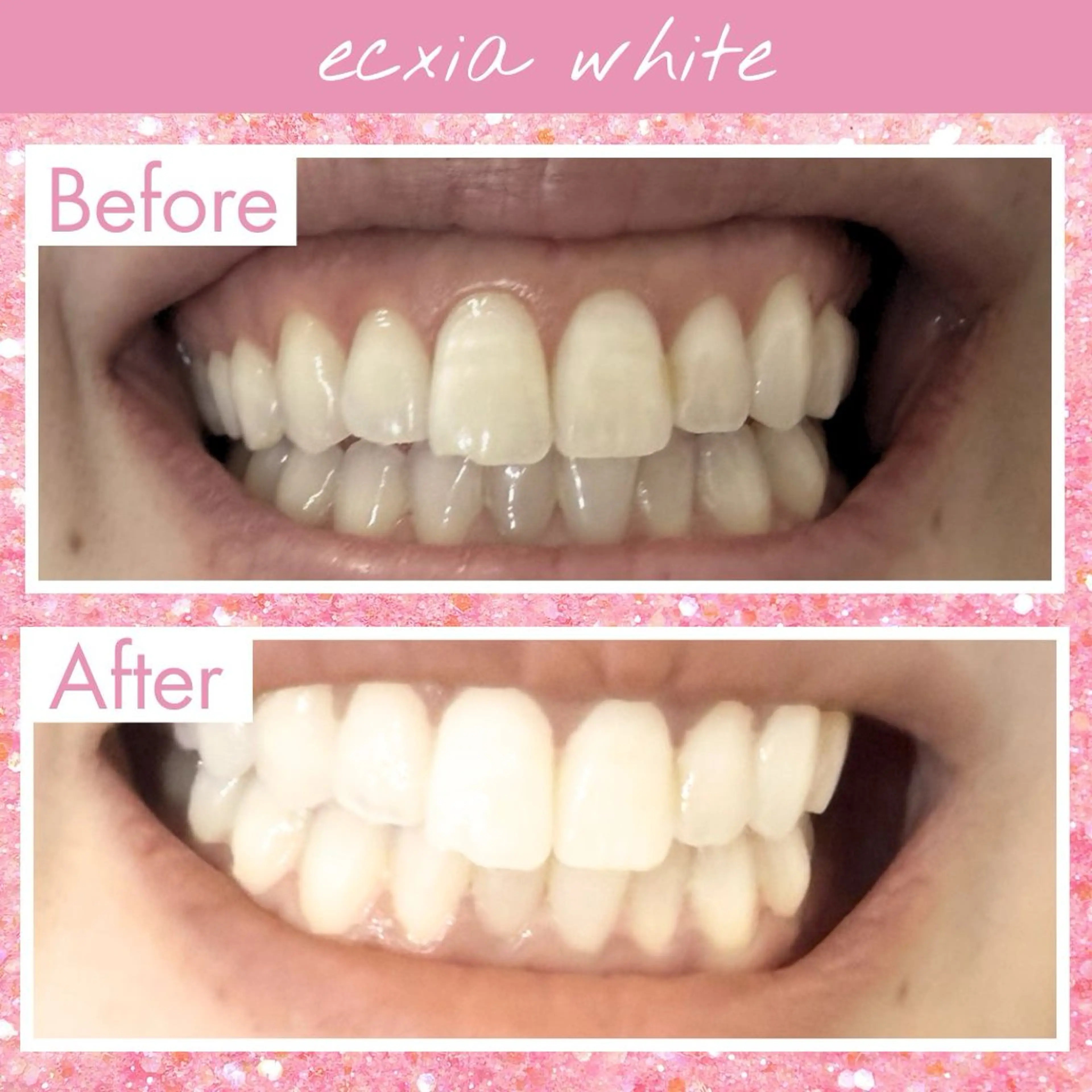 セルフホワイトニング エクシア戸田公園店所属・セルフホワイトニング エクシア戸田公園店のその他イメージ