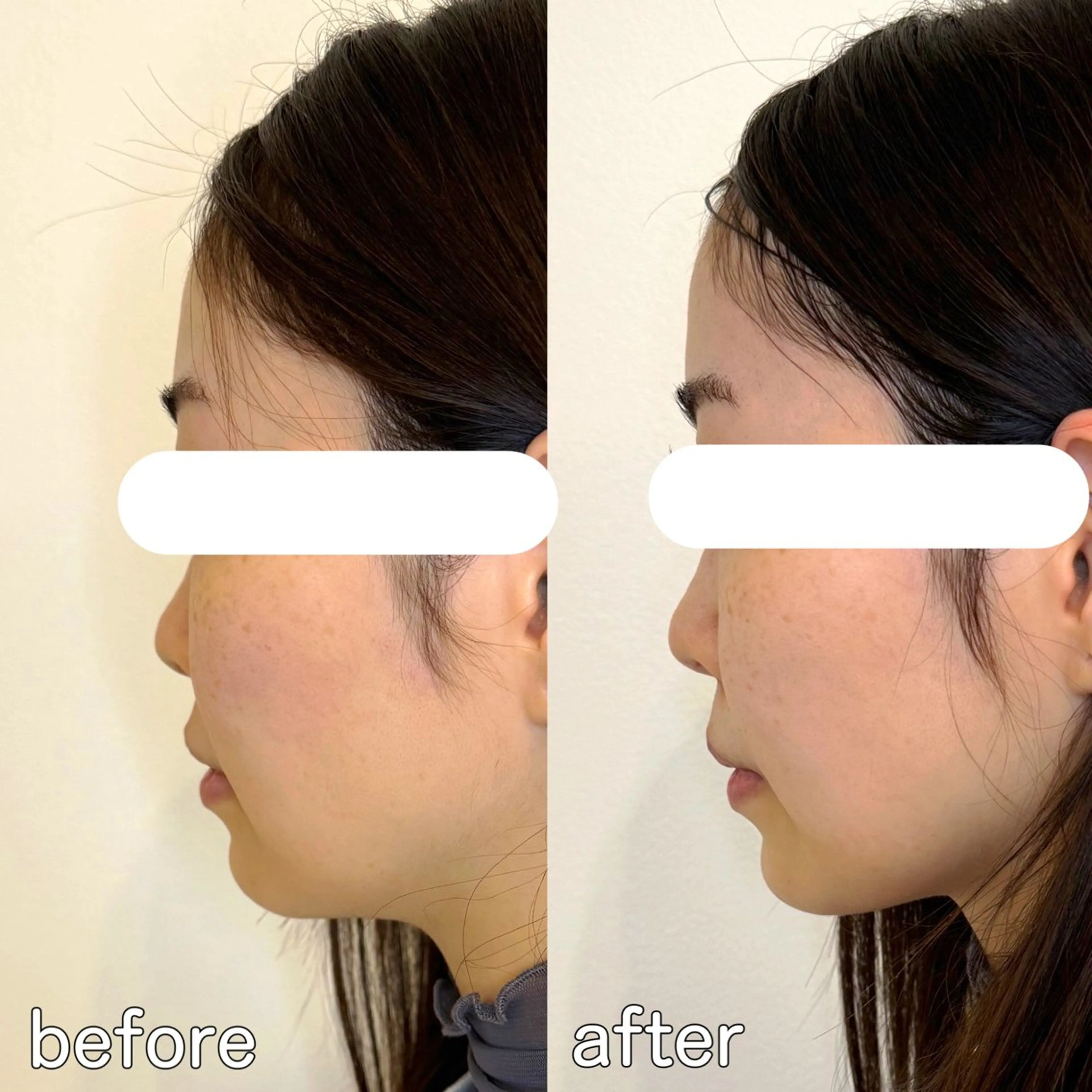 小顔矯正&美容整体 整え屋REDオーナーのエステ・リラクイメージ