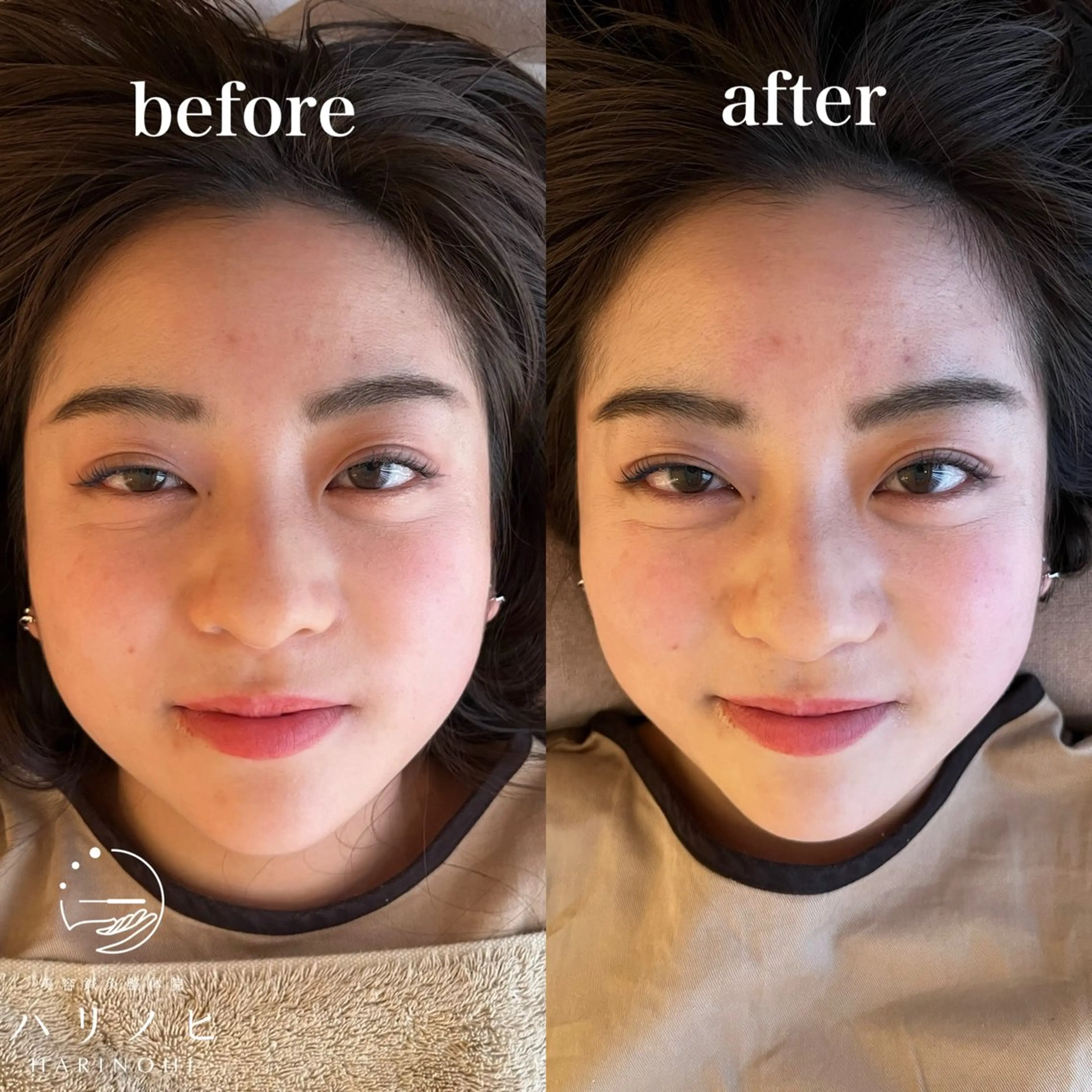 エステ リラク 美容鍼灸整体院 ハリノヒ大阪院のエステ・リラクイメージ