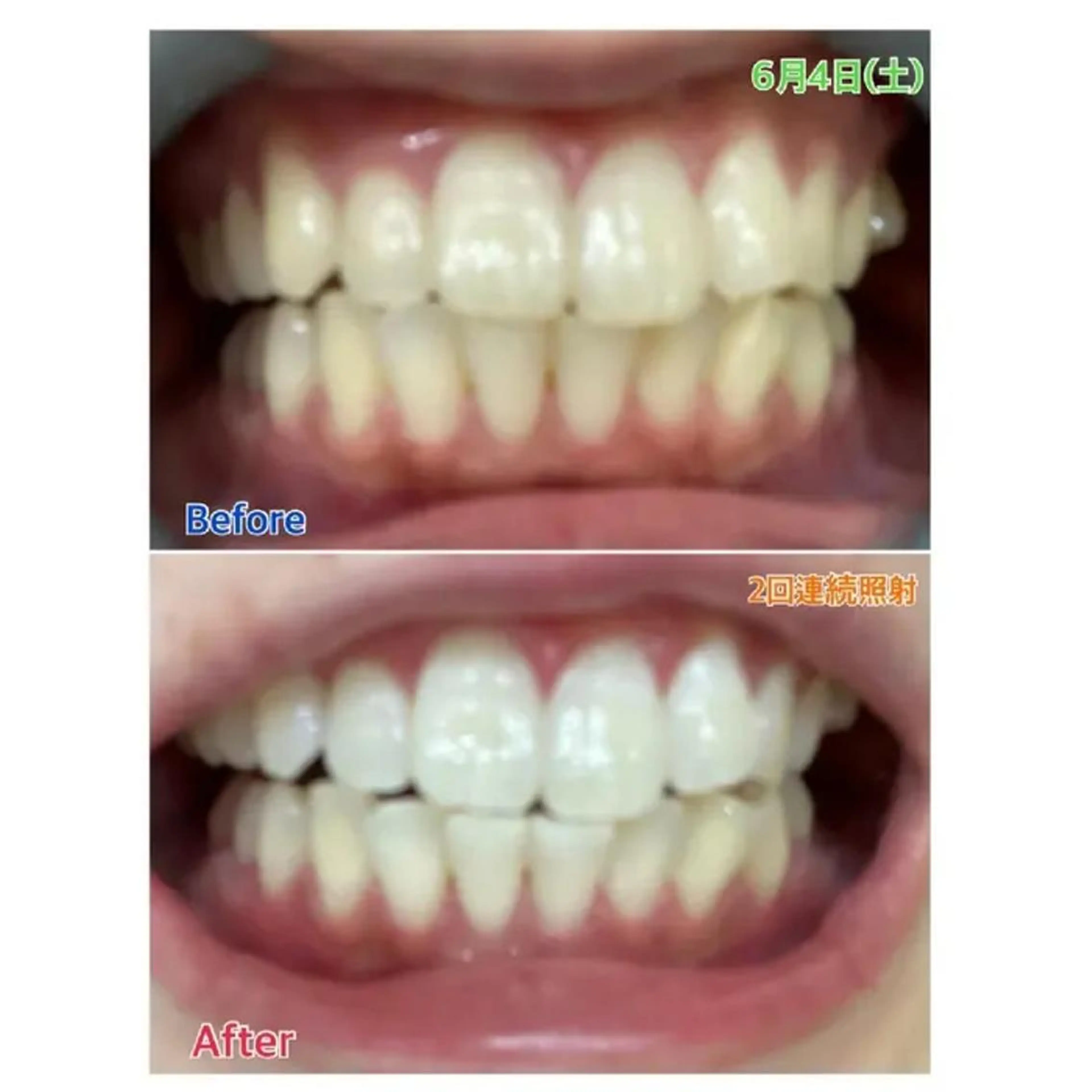 M渋谷店所属・Ｍ渋谷 ホワイトニングのその他イメージ