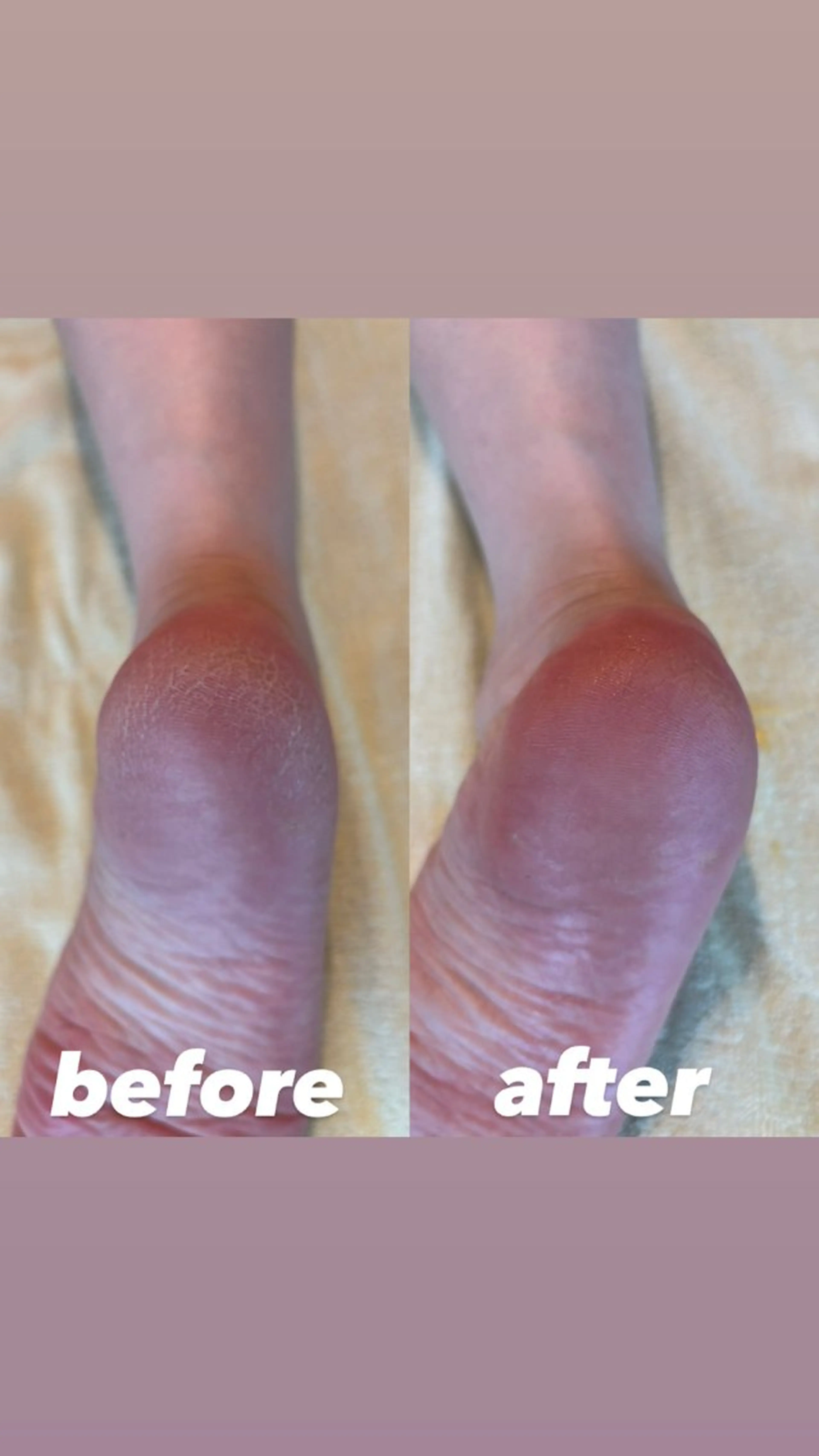 une所属・une シュガーリング脱毛のエステ・リラクイメージ