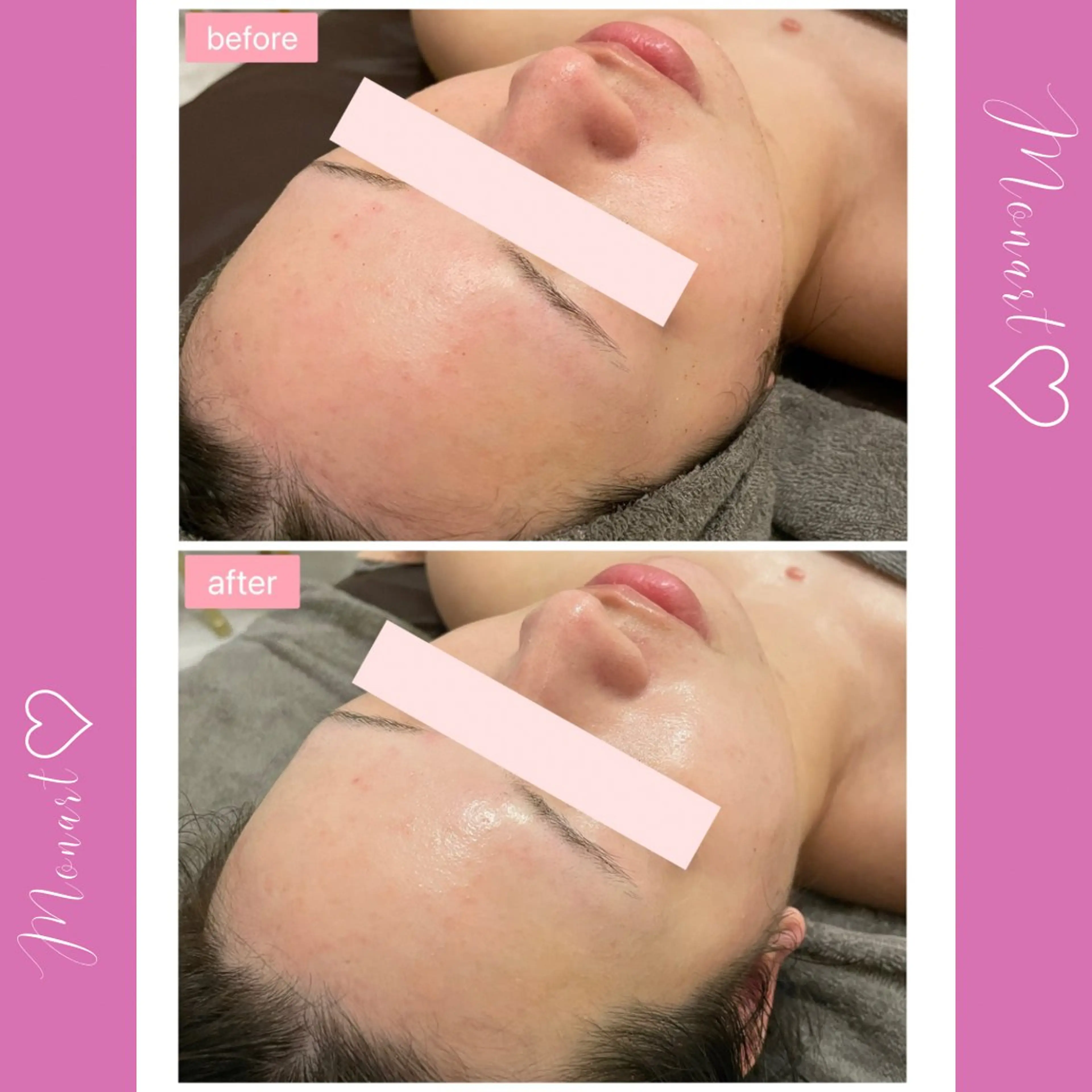 Monart -deux-のエステ・リラクイメージ