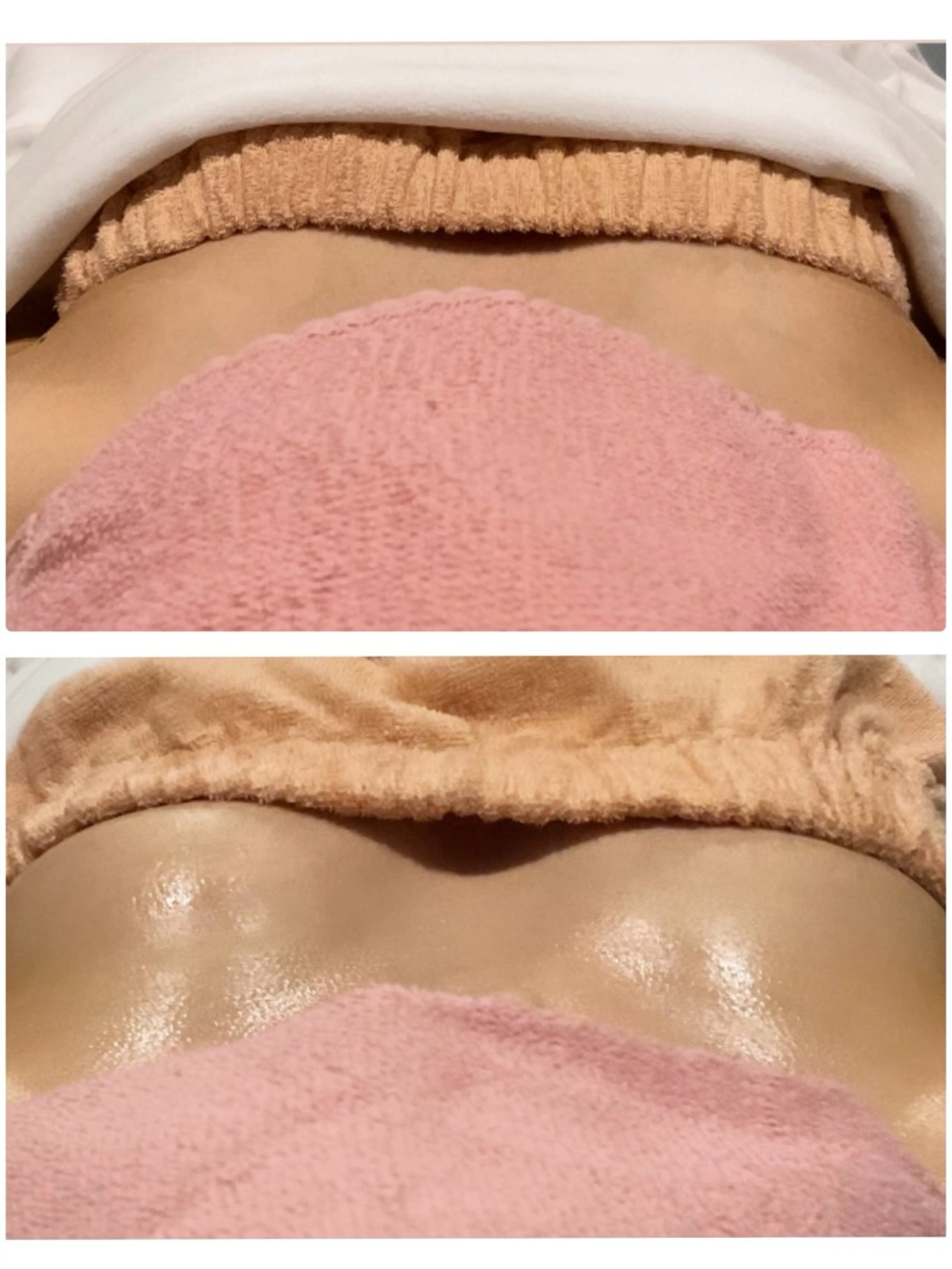 マシュマロバストアップღふわふわもちもちの写真