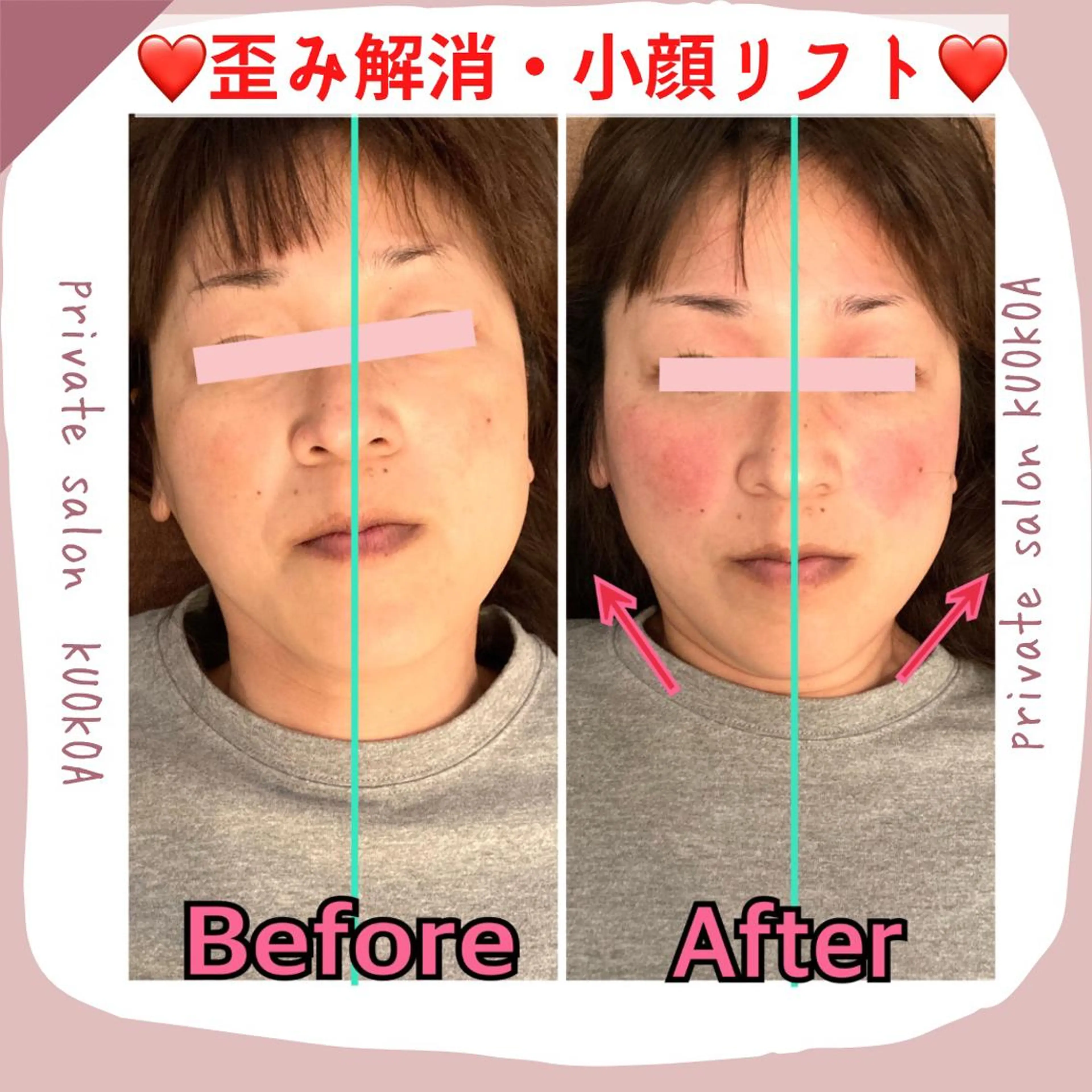 中目黒  整体 小顔 KUOKOAのエステ・リラクイメージ