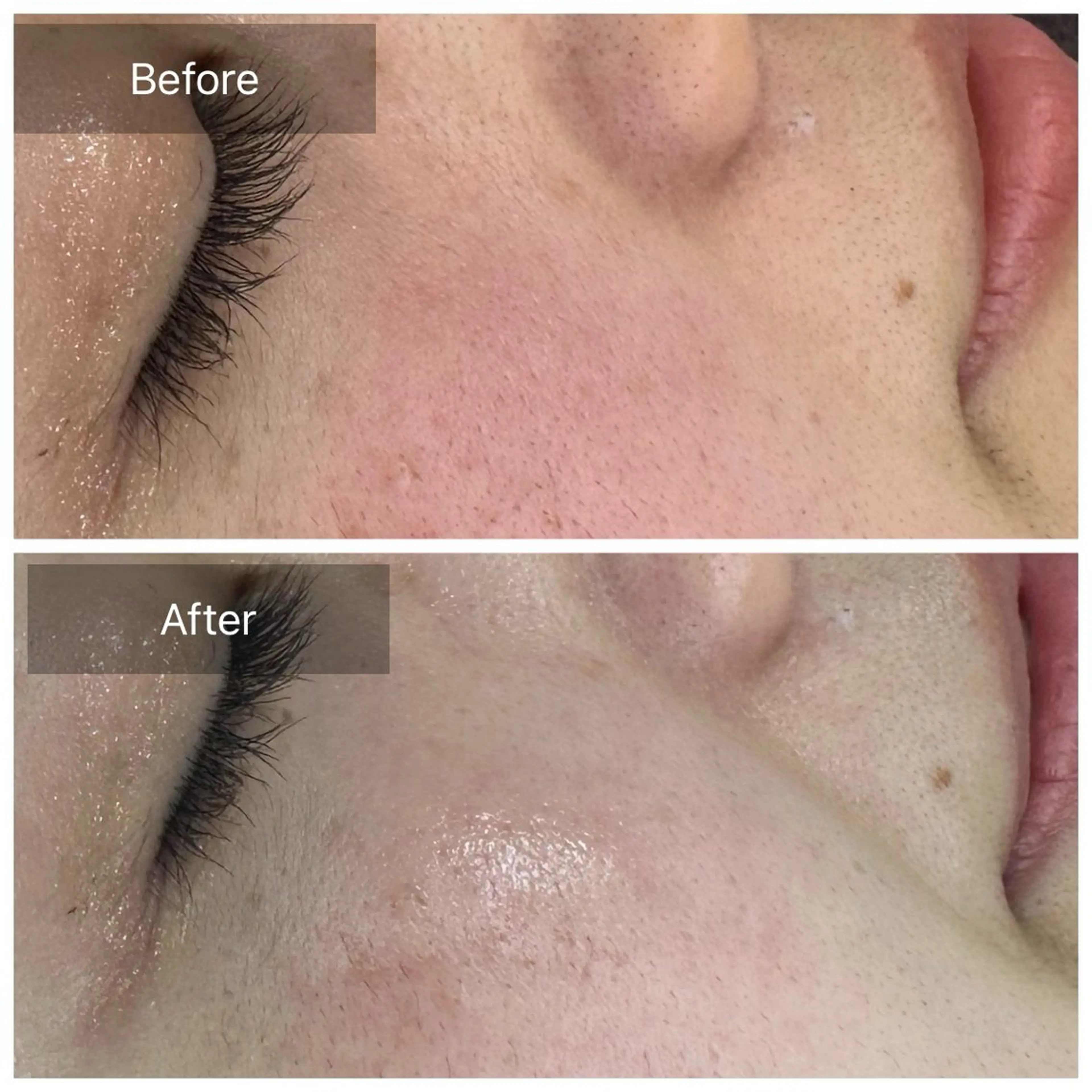 脱毛 トータルしみケア専門 NICA(ニカ)のエステ・リラクイメージ