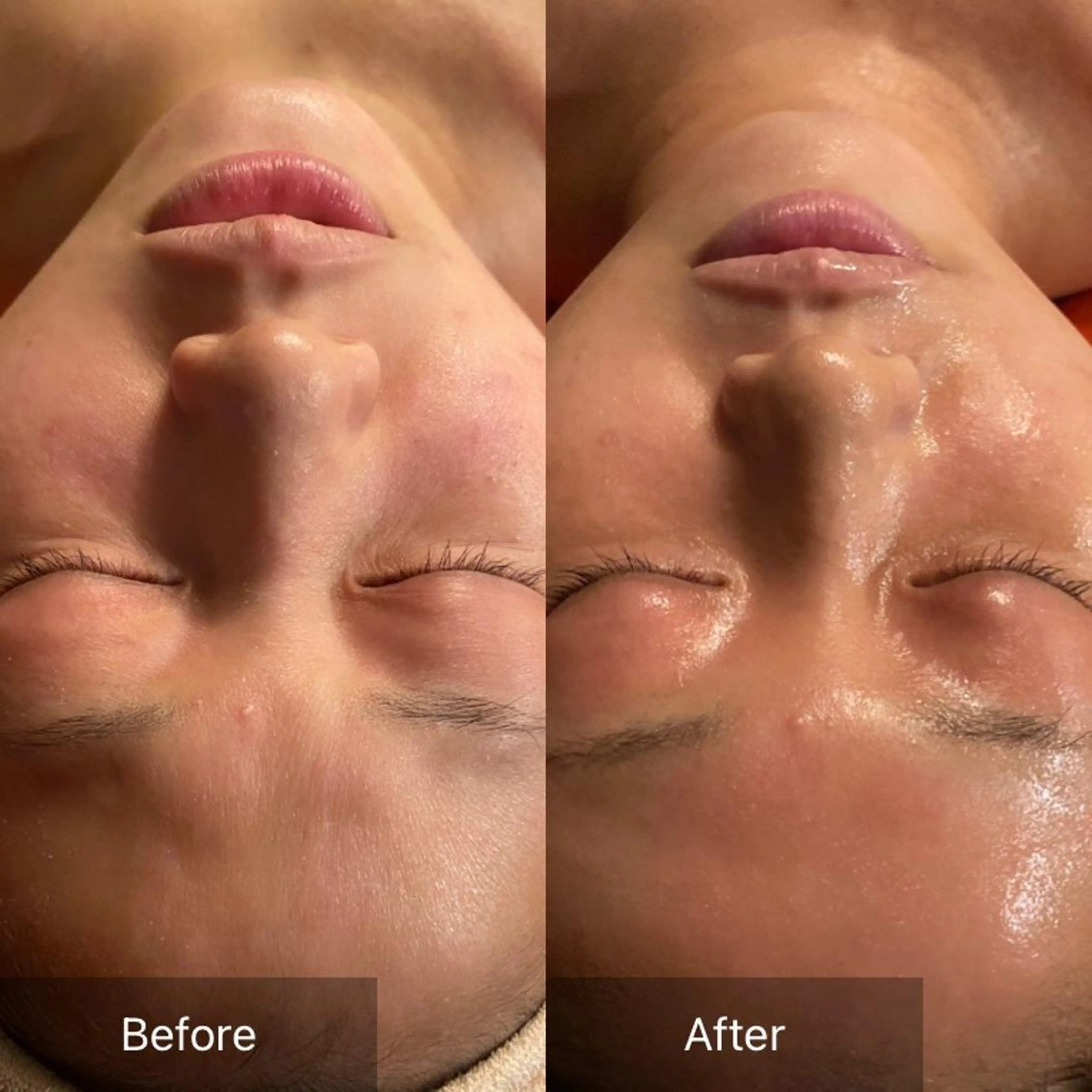 Mandarin Orange所属・毛穴から始める肌メン テマンダリンオレンジのエステ・リラクイメージ