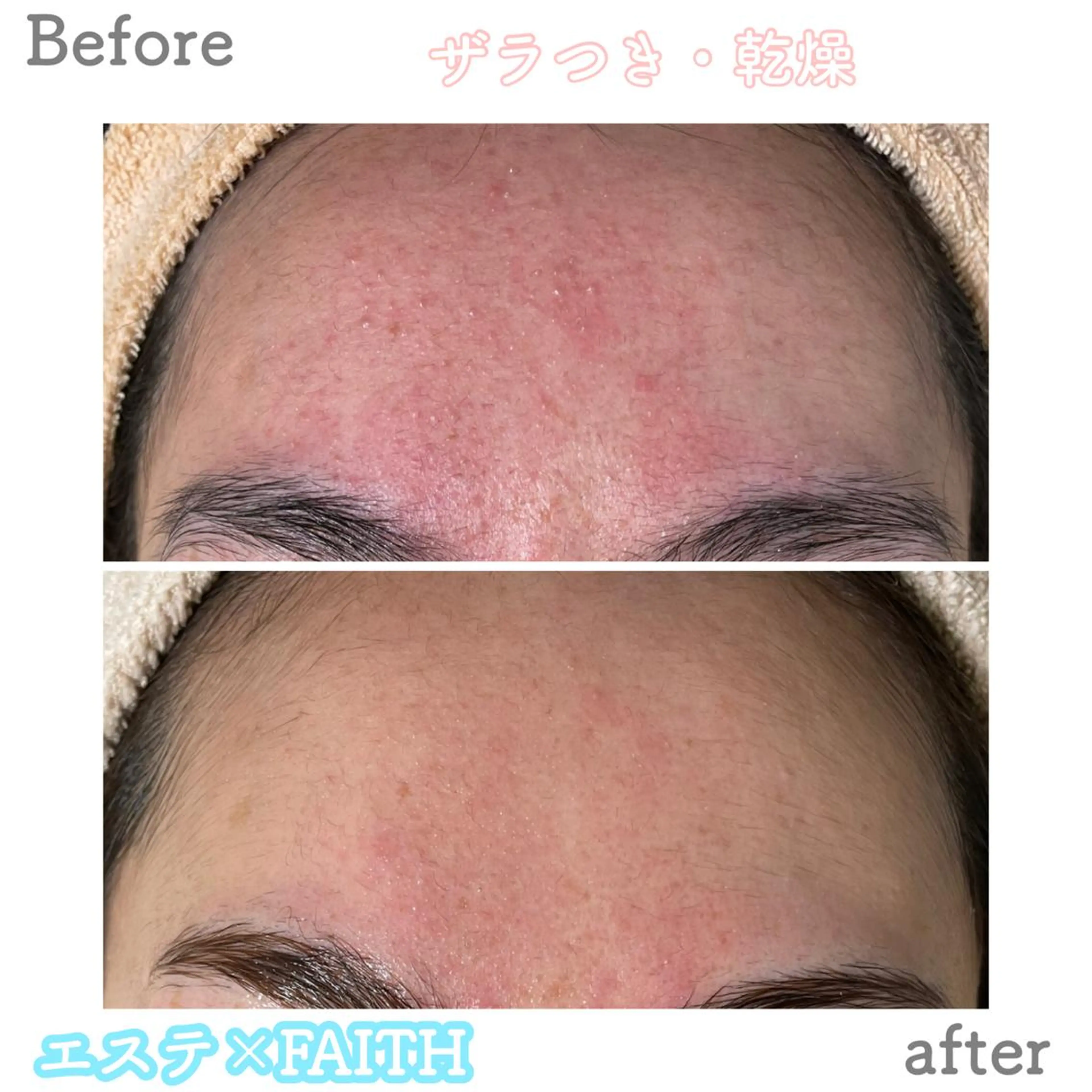 ショート パーマ ヘアアレンジ メンズ キッズ ネイル マツエク・マツパ アイブロウ エステ ニキビ&跡改善サロン オーナー光木のエステ・リラクイメージ