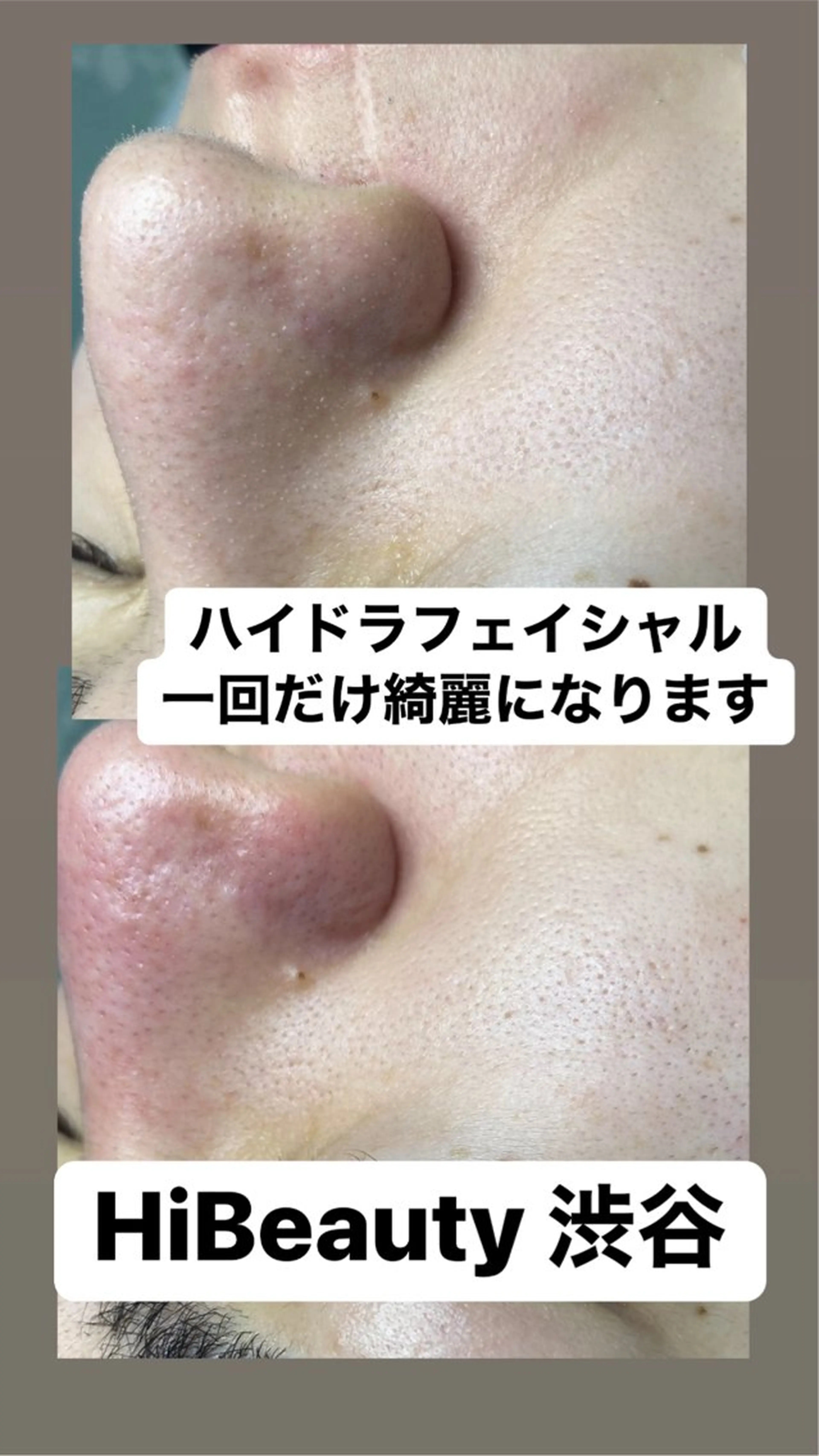 エステ リラク Hi Beauty 渋谷(ネイル、ハイパーナイフ6、脂肪れいきゃく、マッサージ＆エステサロン)所属・Hi beauty 渋谷のネイルデザイン