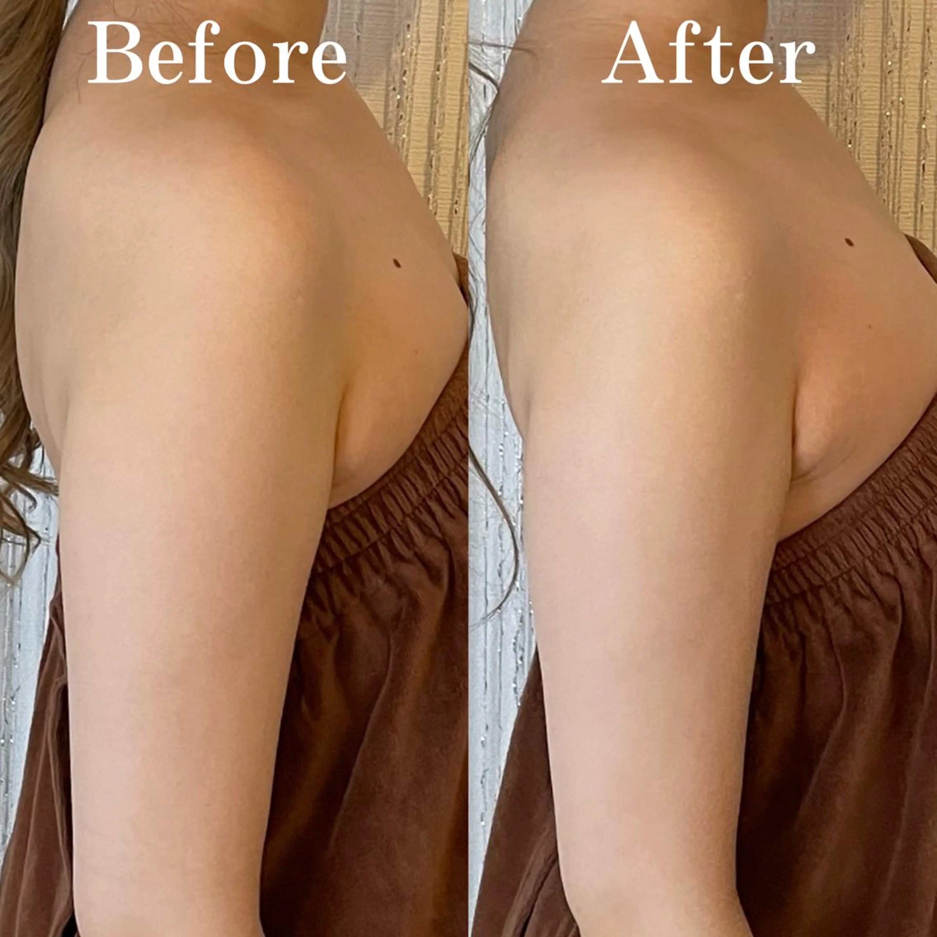 【マタニティ】結果重視のブライダル痩身＆小顔　100分の写真