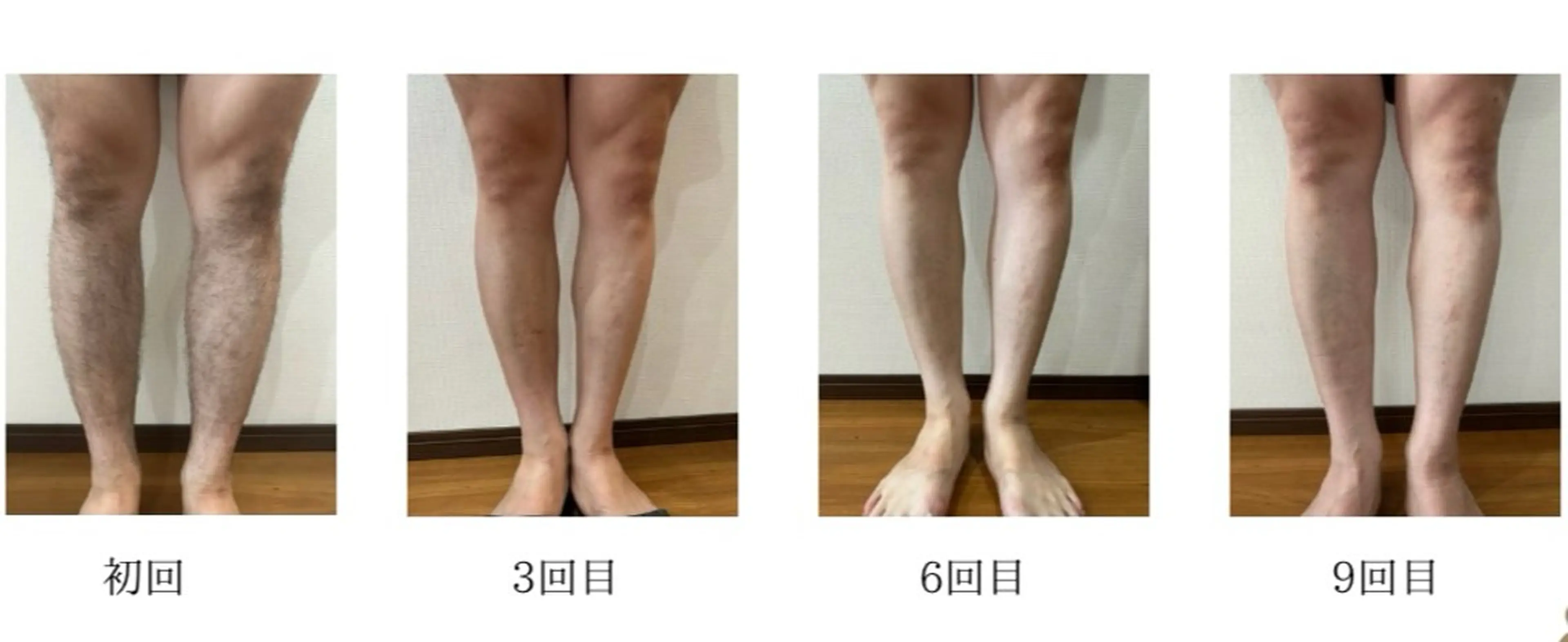 EstheticSalonReTweet所属・竹谷 春希のエステ・リラクイメージ