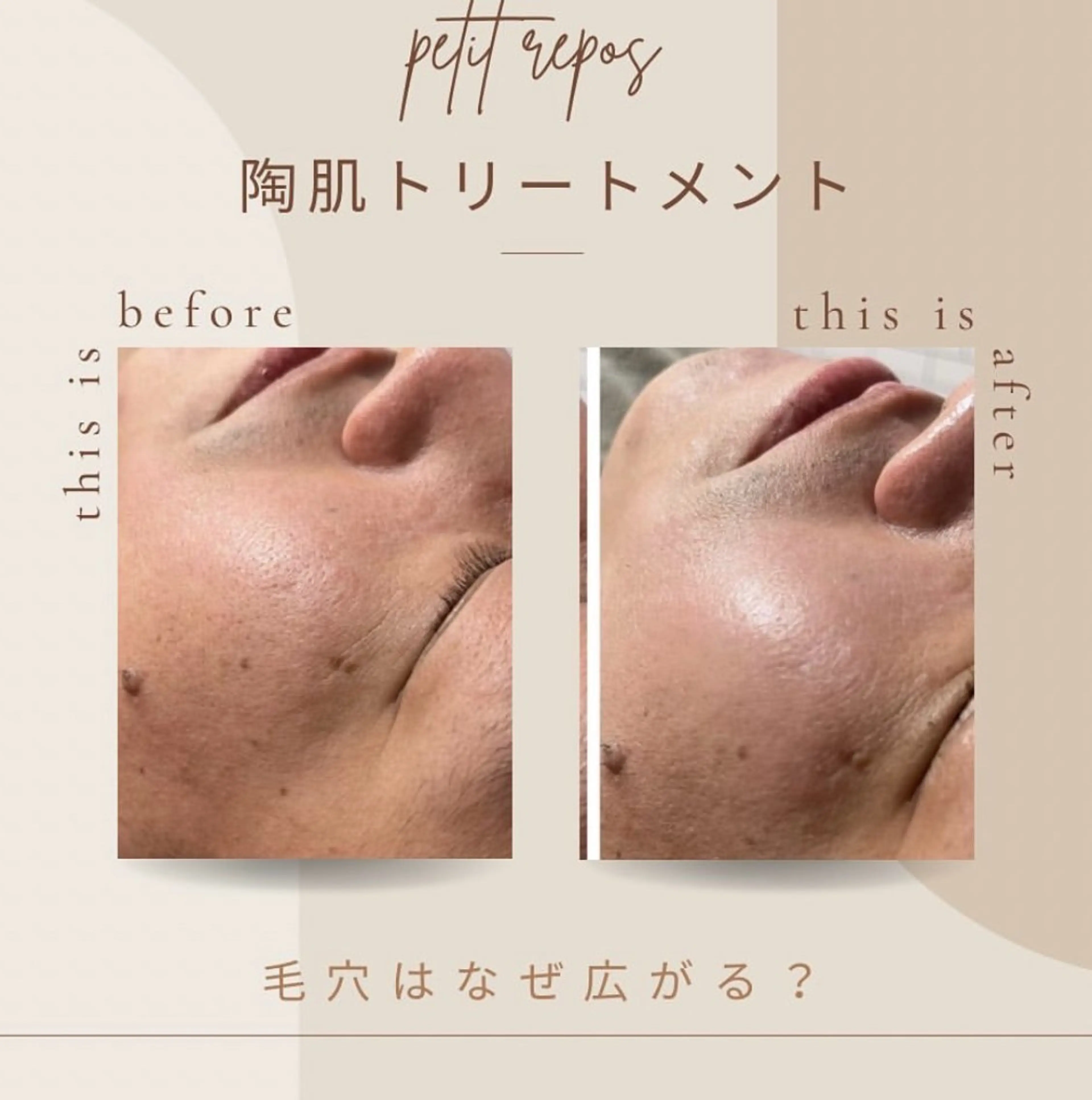 エステ petit repos所属・吉田 和のエステ・リラクイメージ