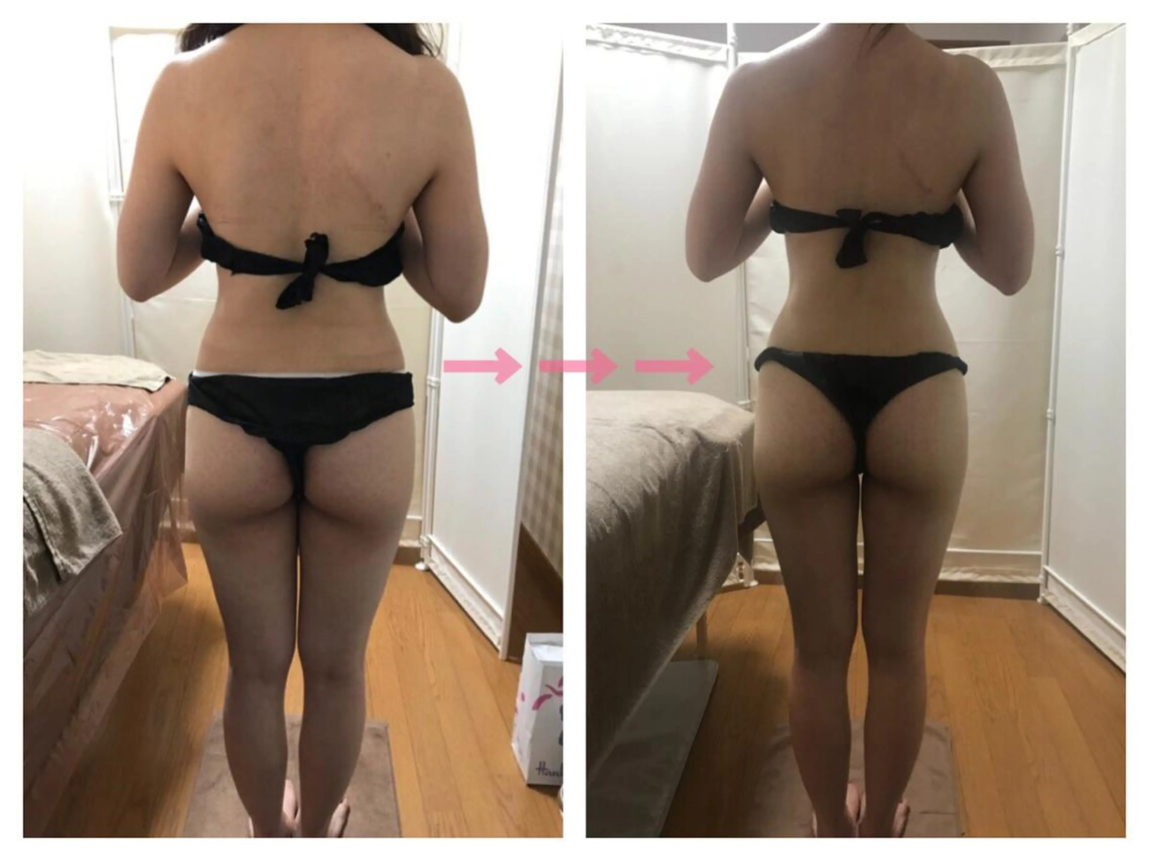 biloop所属・《痩身×疲労改善》 BILOOPのエステ・リラクイメージ