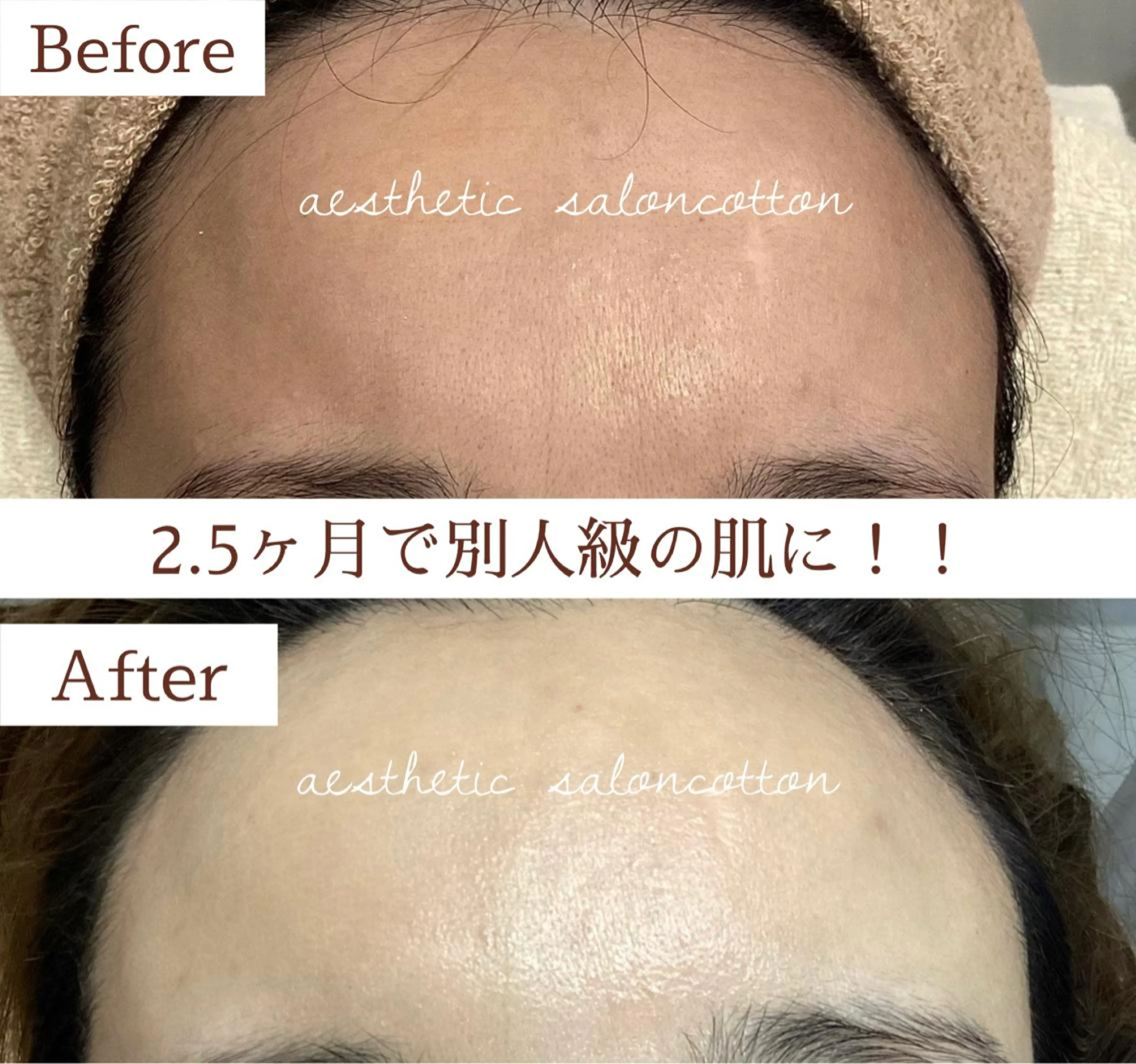 都度払い 肌質改善専門サロンのエステ・リラクイメージ