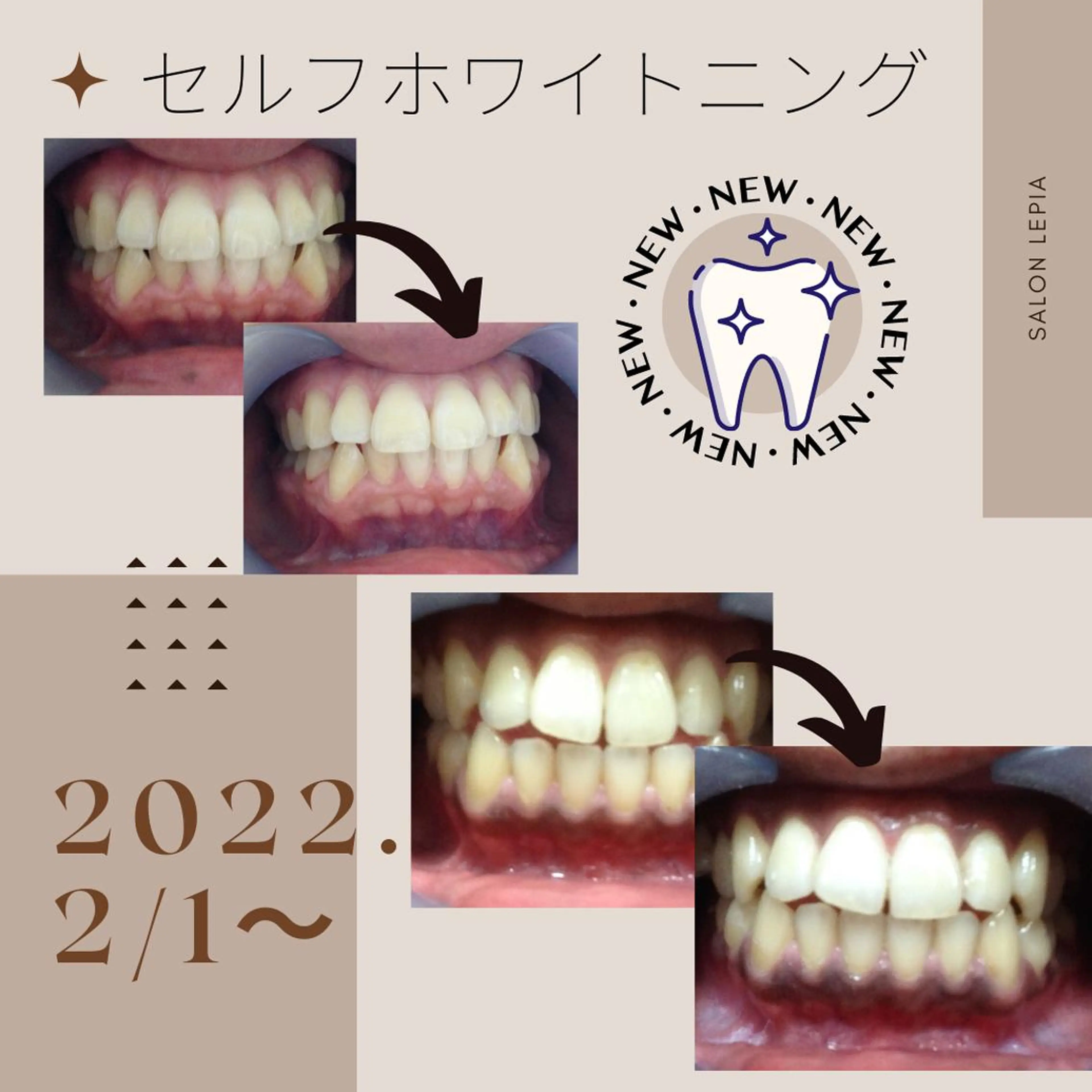 男女同額完全個室脱毛 LEPIA内田のエステ・リラクイメージ