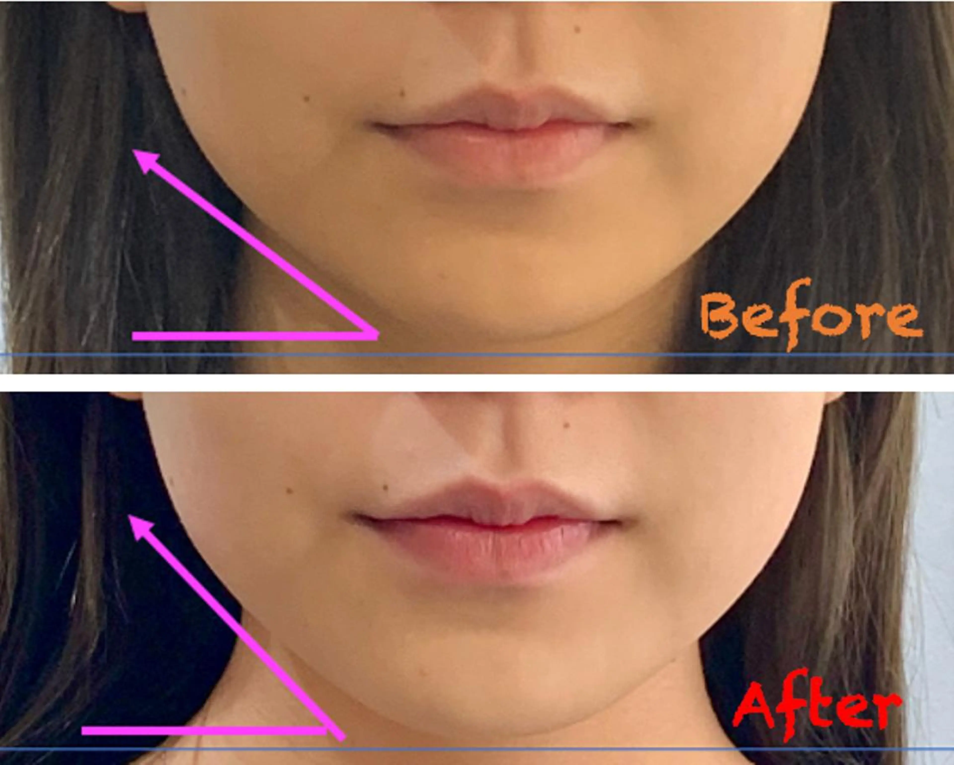 小顔美肌&痩身ｻﾛﾝ My Timeのエステ・リラクイメージ