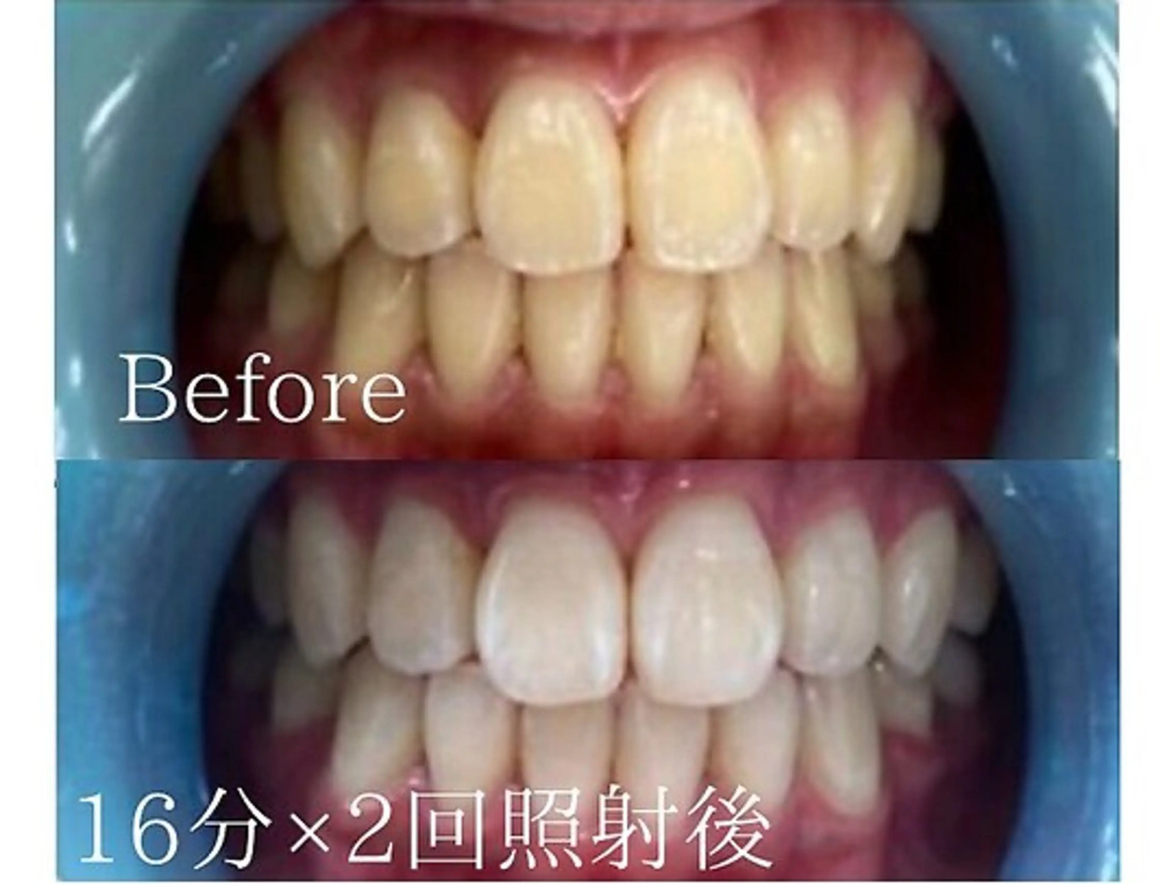 ホワイトニングカフェ荻窪店所属・ホワイトニングカフェ 荻窪店のその他イメージ