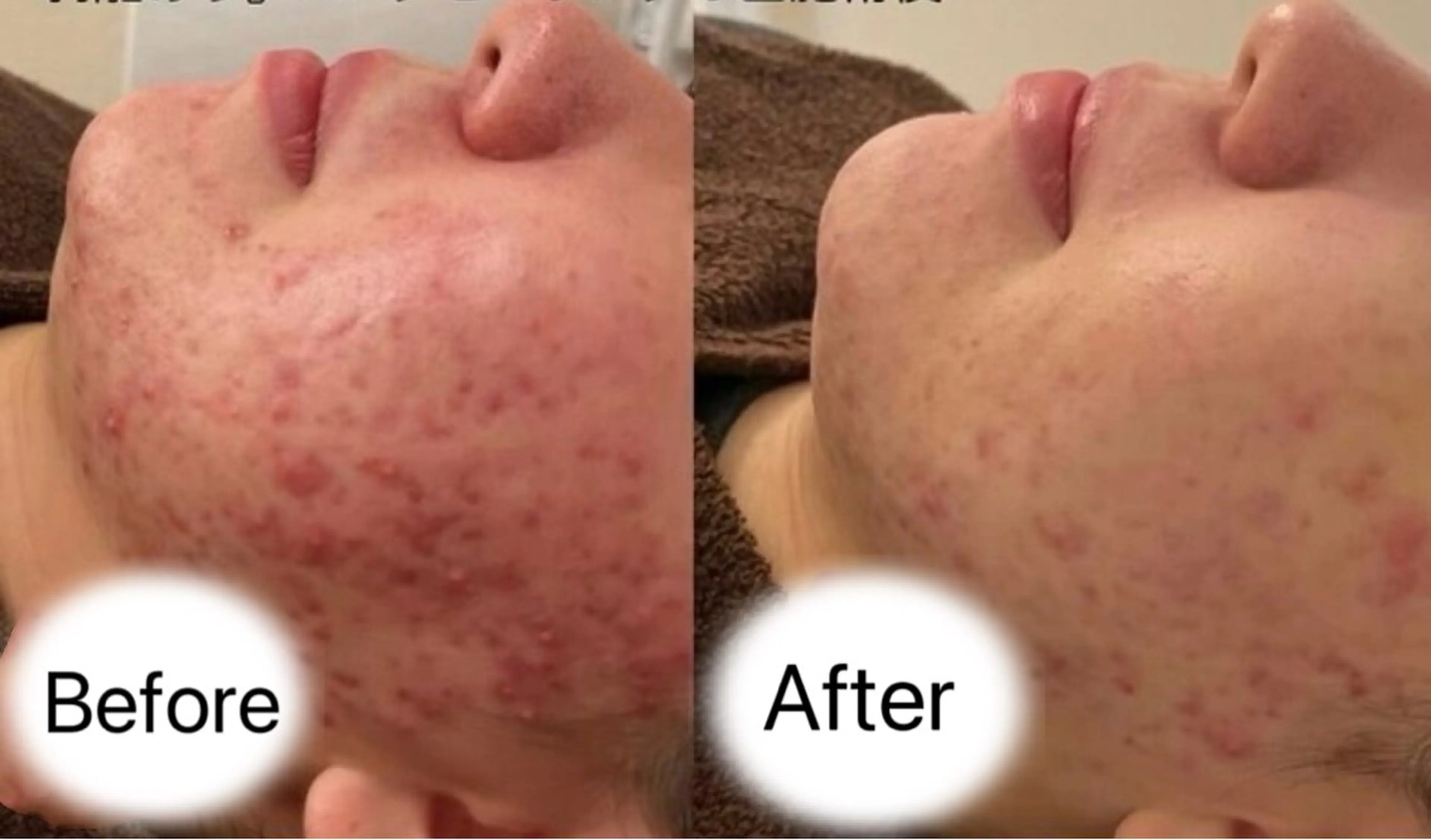 Belle原宿所属・佐藤 加奈のエステ・リラクイメージ