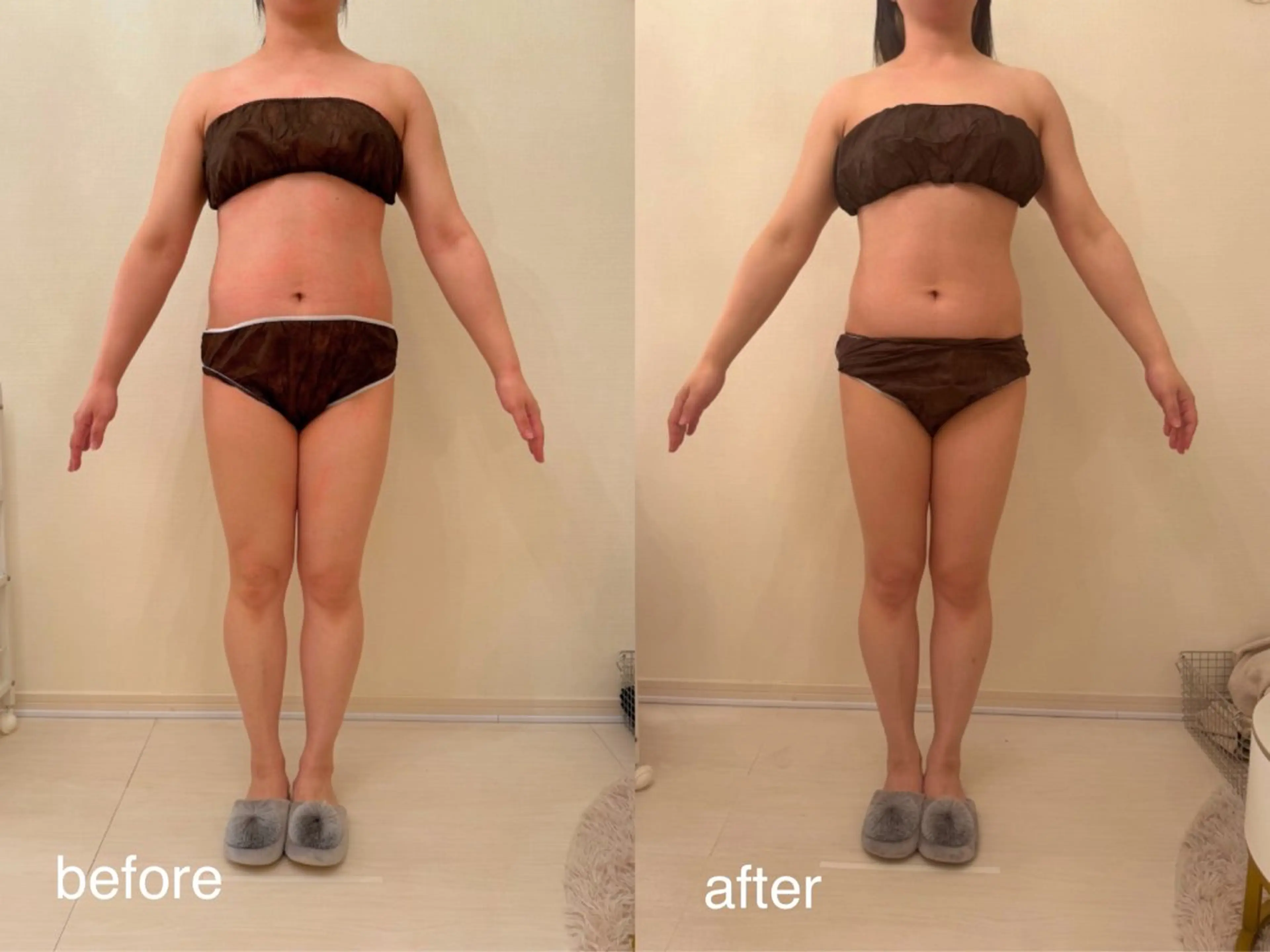 エステ 小顔×痩身専門サロンCLORE浦和店所属・石川 彩花のエステ・リラクイメージ