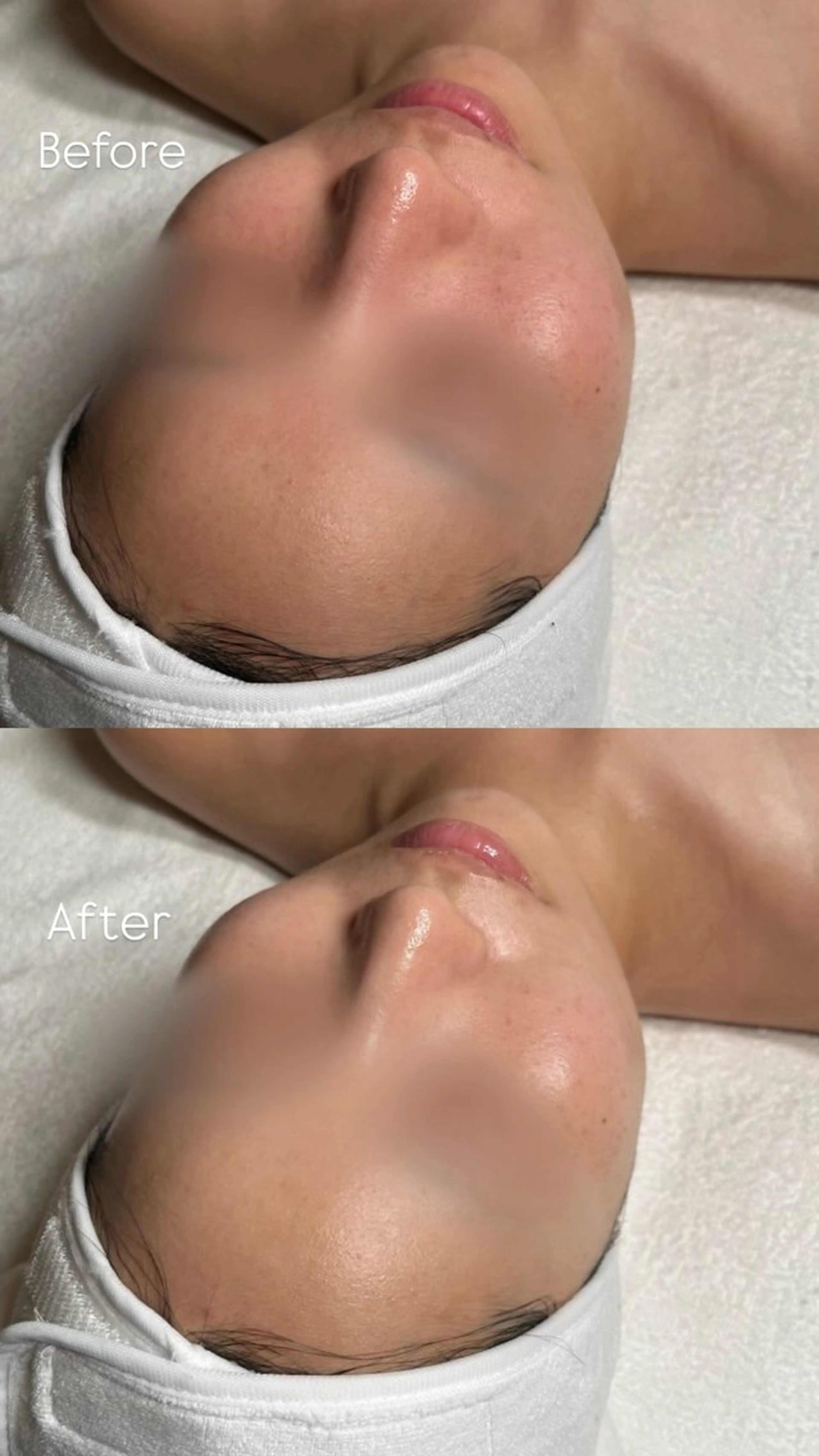 韓国肌管理🫧LDM 🫧Junnaのエステ・リラクイメージ