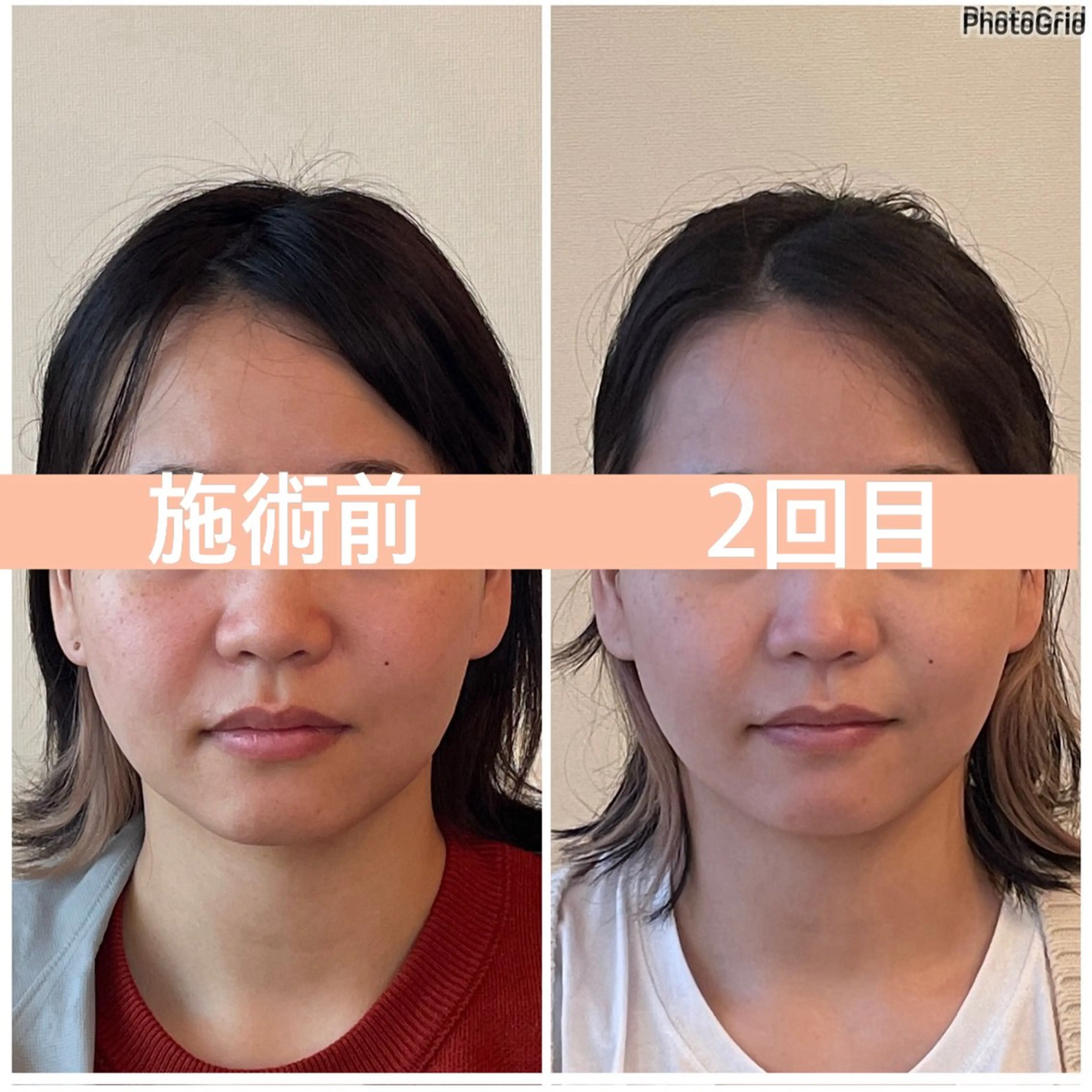 小顔矯正サロン　ReFace Fusae（リフェイスフサエ）所属・小顔矯正サロン リフェイスフサエのエステ・リラクイメージ