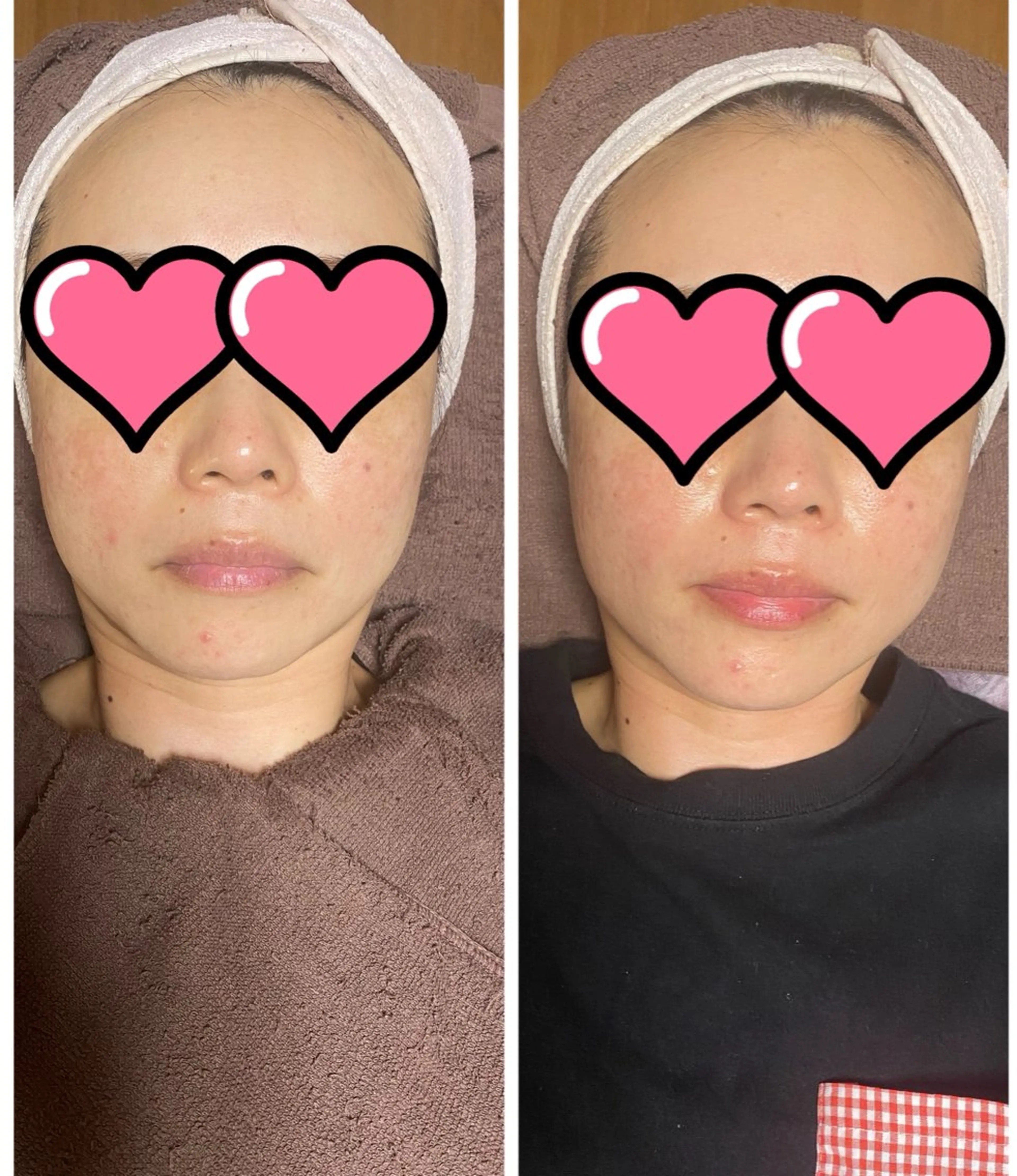 縮顔RE–SETの写真