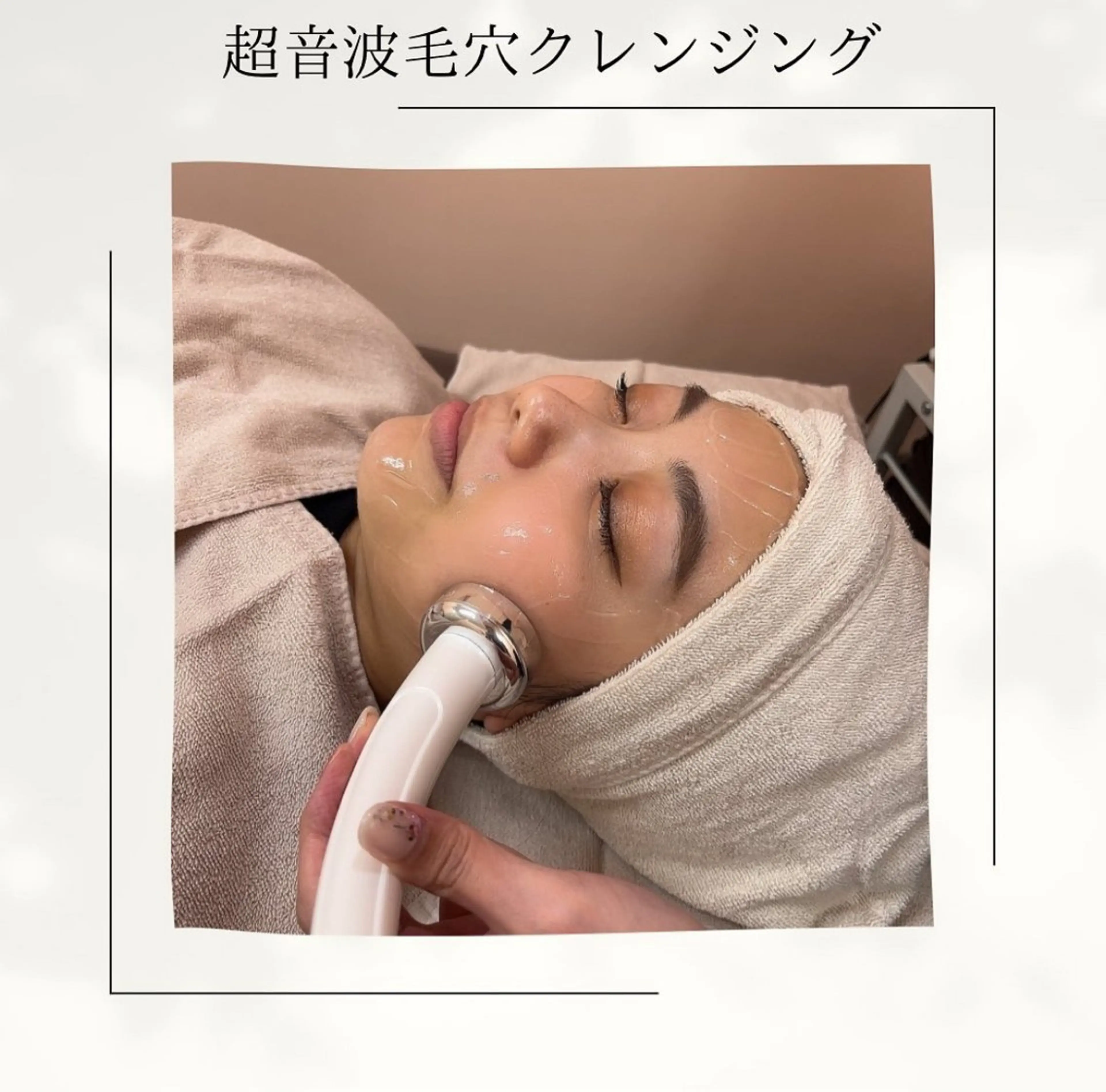 黒ずみやトーンアップ、お化粧ノリが良くなります！超音波毛穴クレンジング（脱毛無料施術チケット付き）の写真
