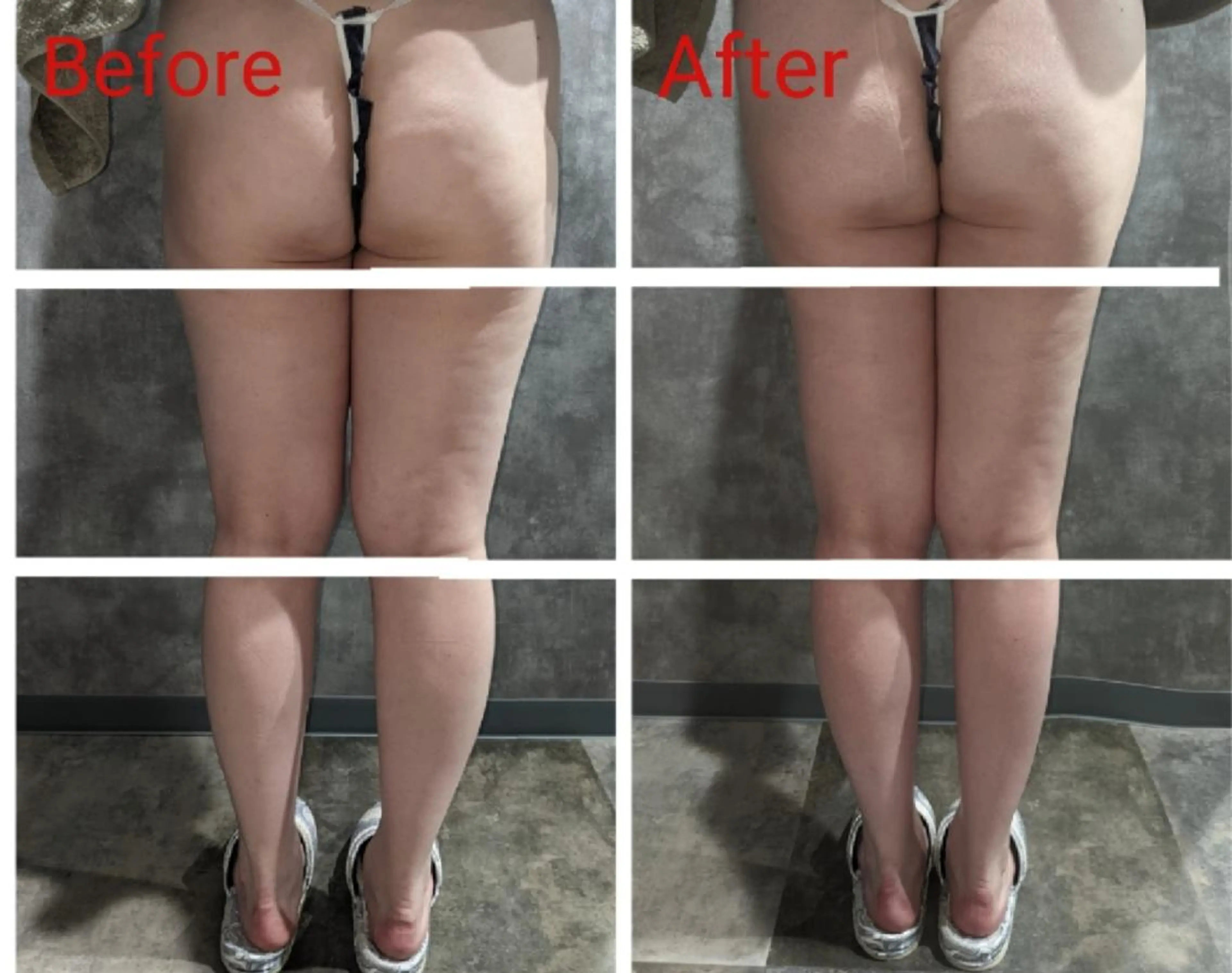 下半身集中(ヒップ)の写真