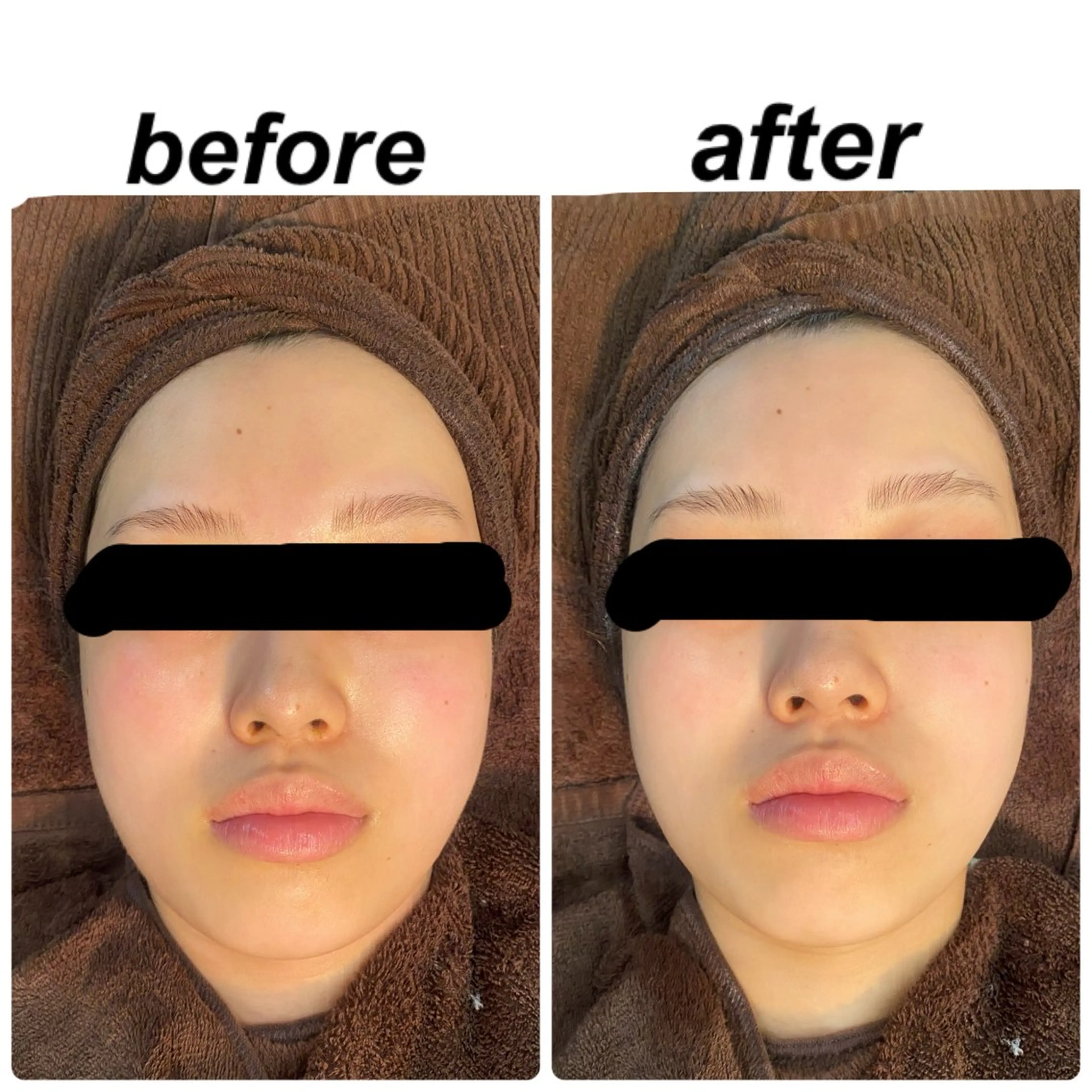 Upm.所属・成島 星哉のエステ・リラクイメージ