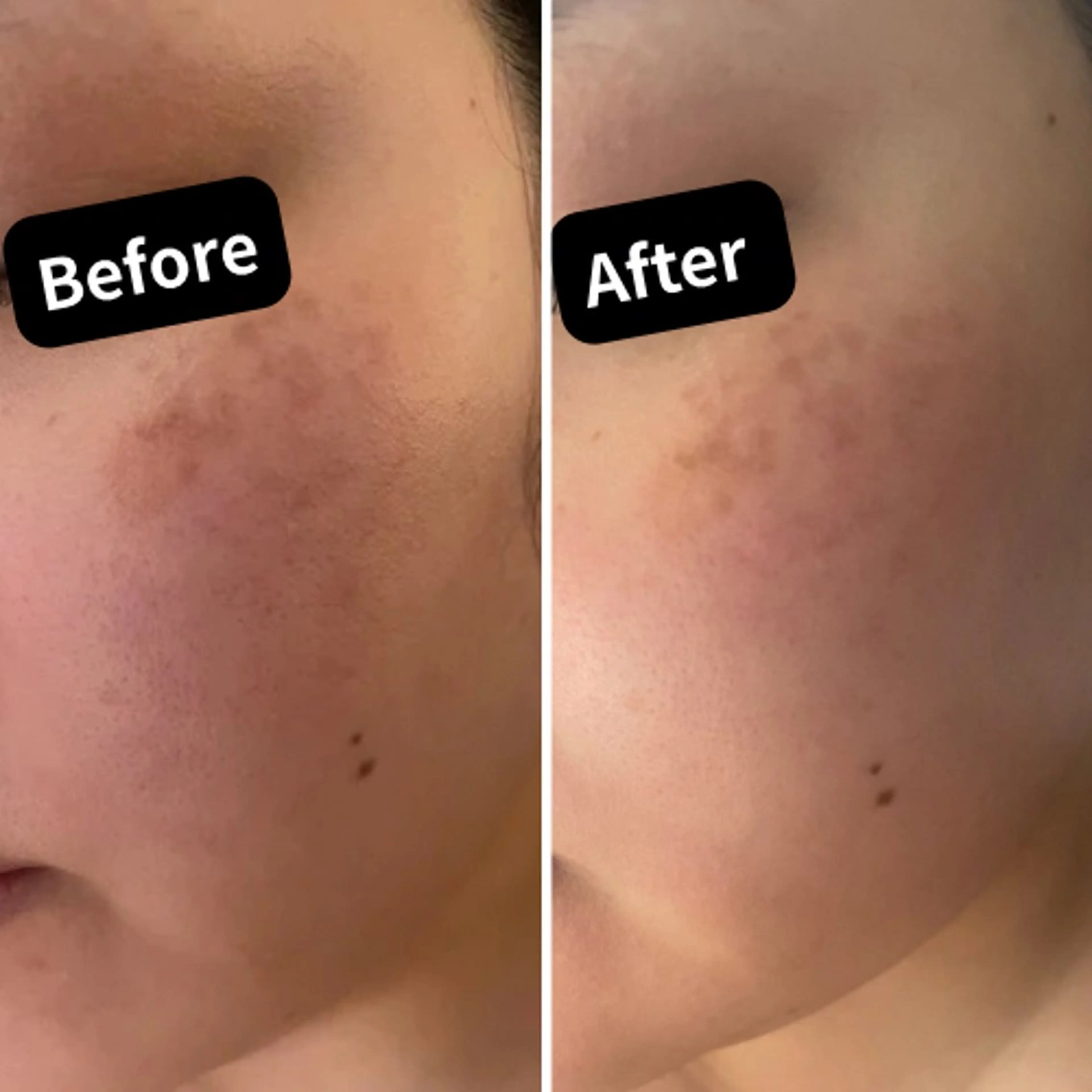 12月限定《シミ・肝斑ケア》選べるパック付🪄の写真