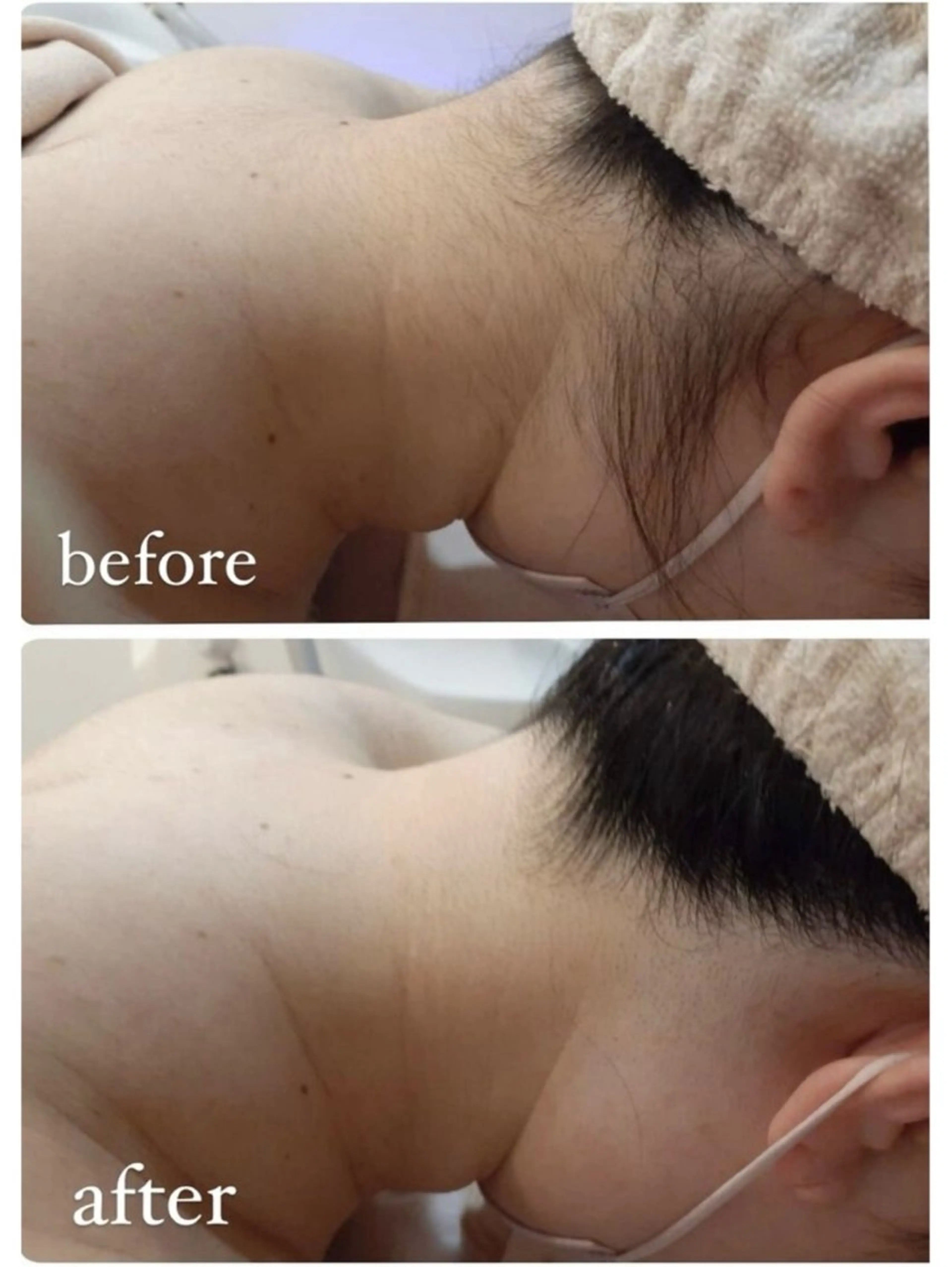 脱毛 RAY Beauty エステ　一宮店のエステ・リラクイメージ