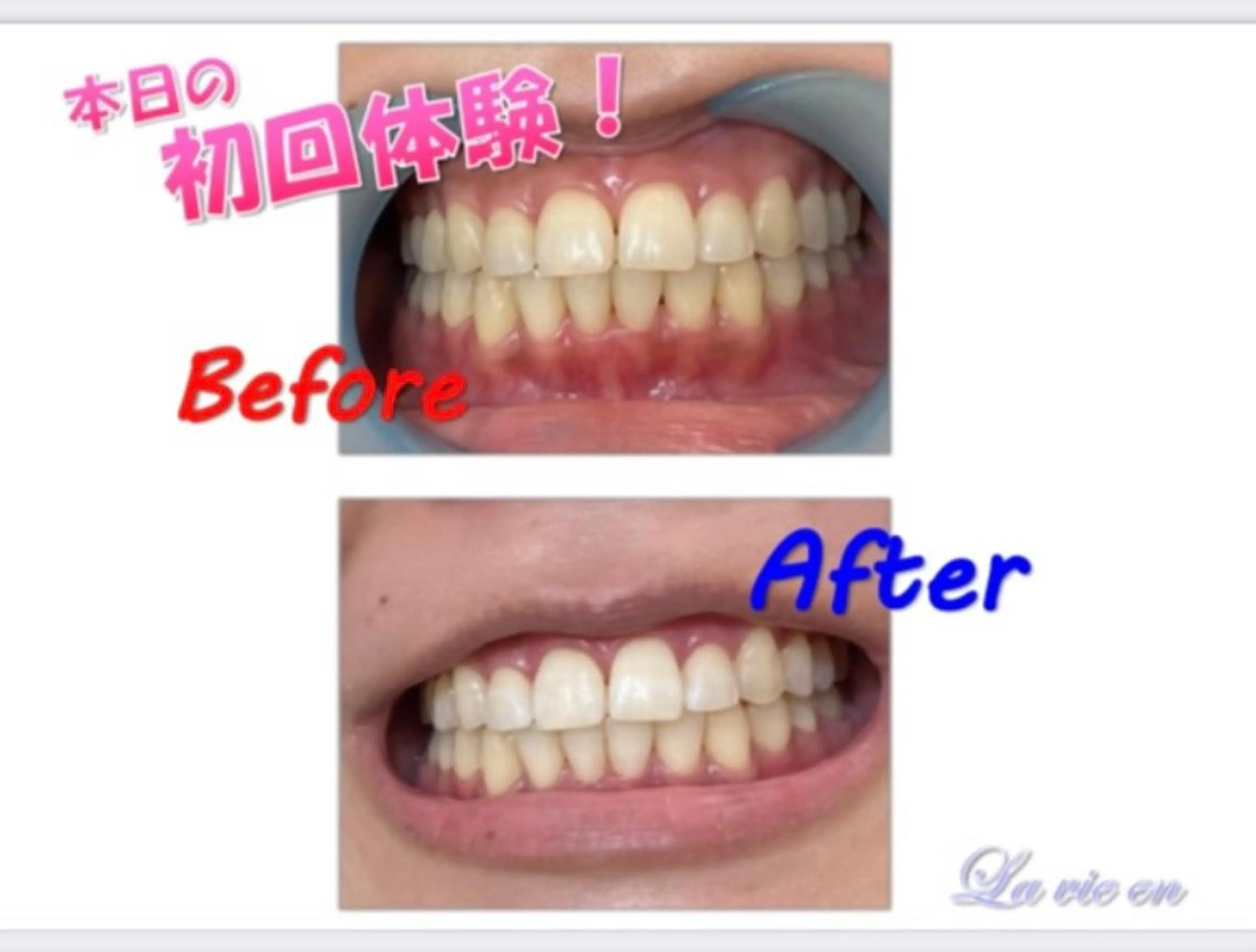 その他 セルフホワイトニングサロン　ラヴィアン所属・ホワイトニングサロン La vie enのその他イメージ