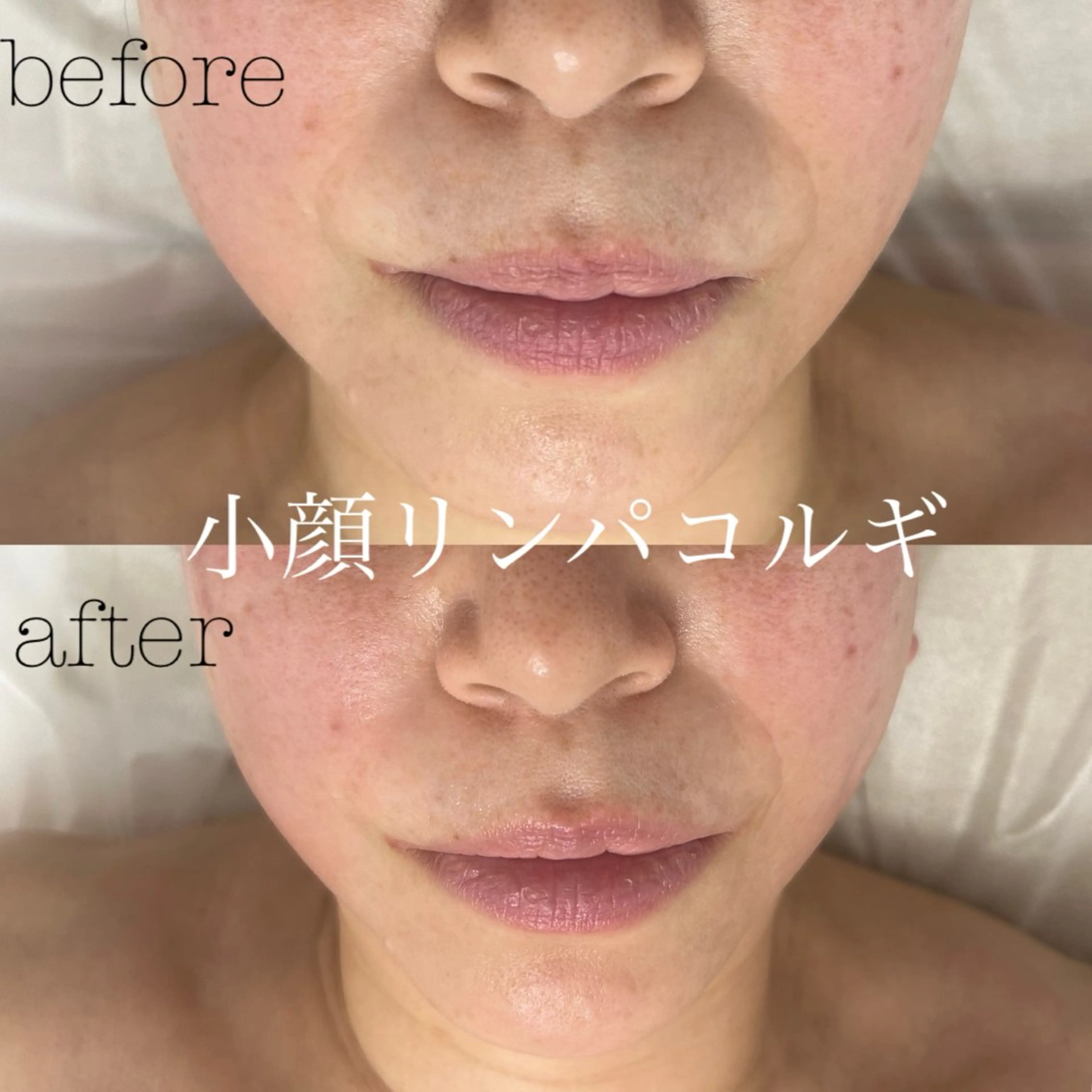 メンズ フェイシャルサロン CHIARA 荒田のエステ・リラクイメージ