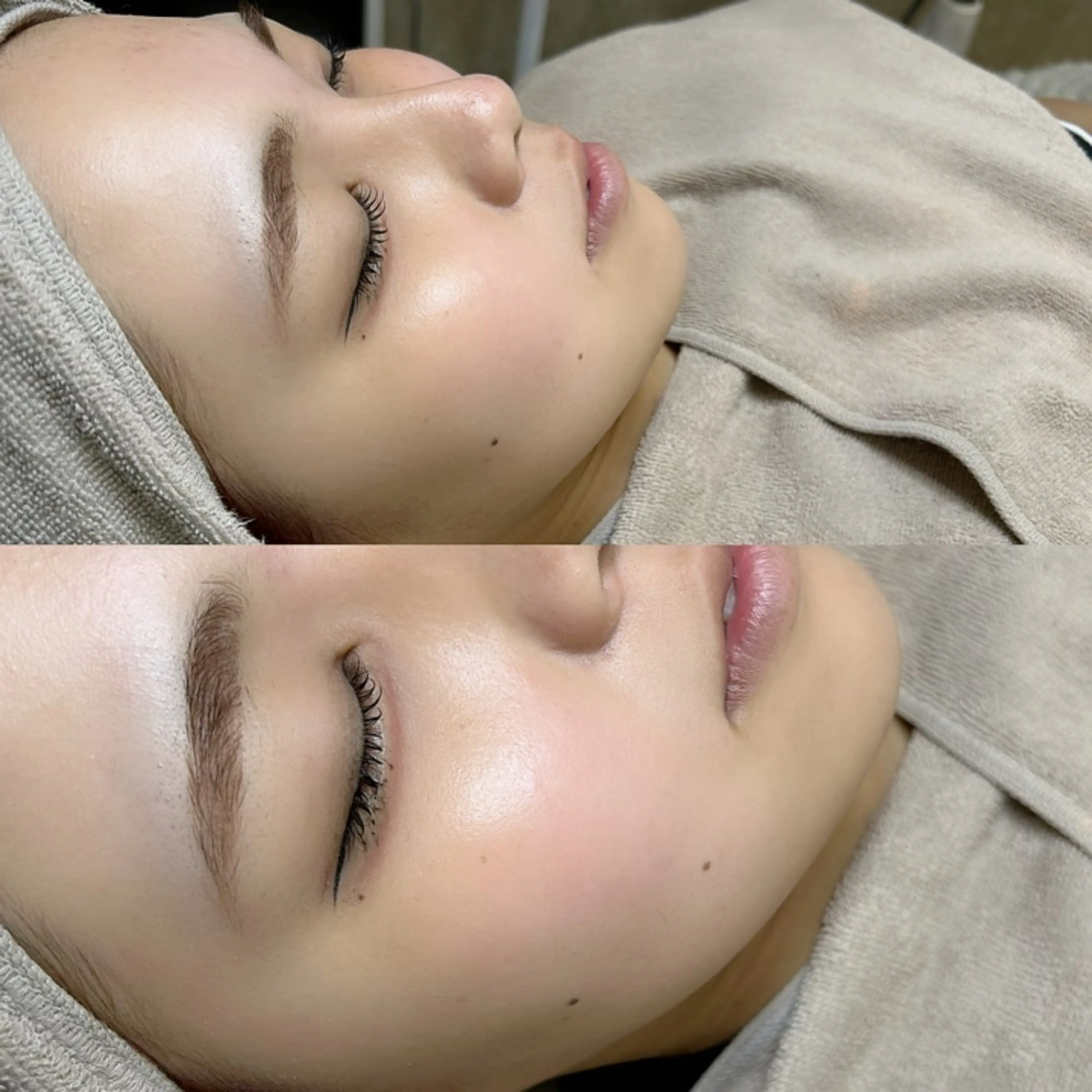 💎前撮り・イベント前にオススメ💎レディースシェービング（襟剃り＋全顔＋眉）🪞🪄︎︎の写真