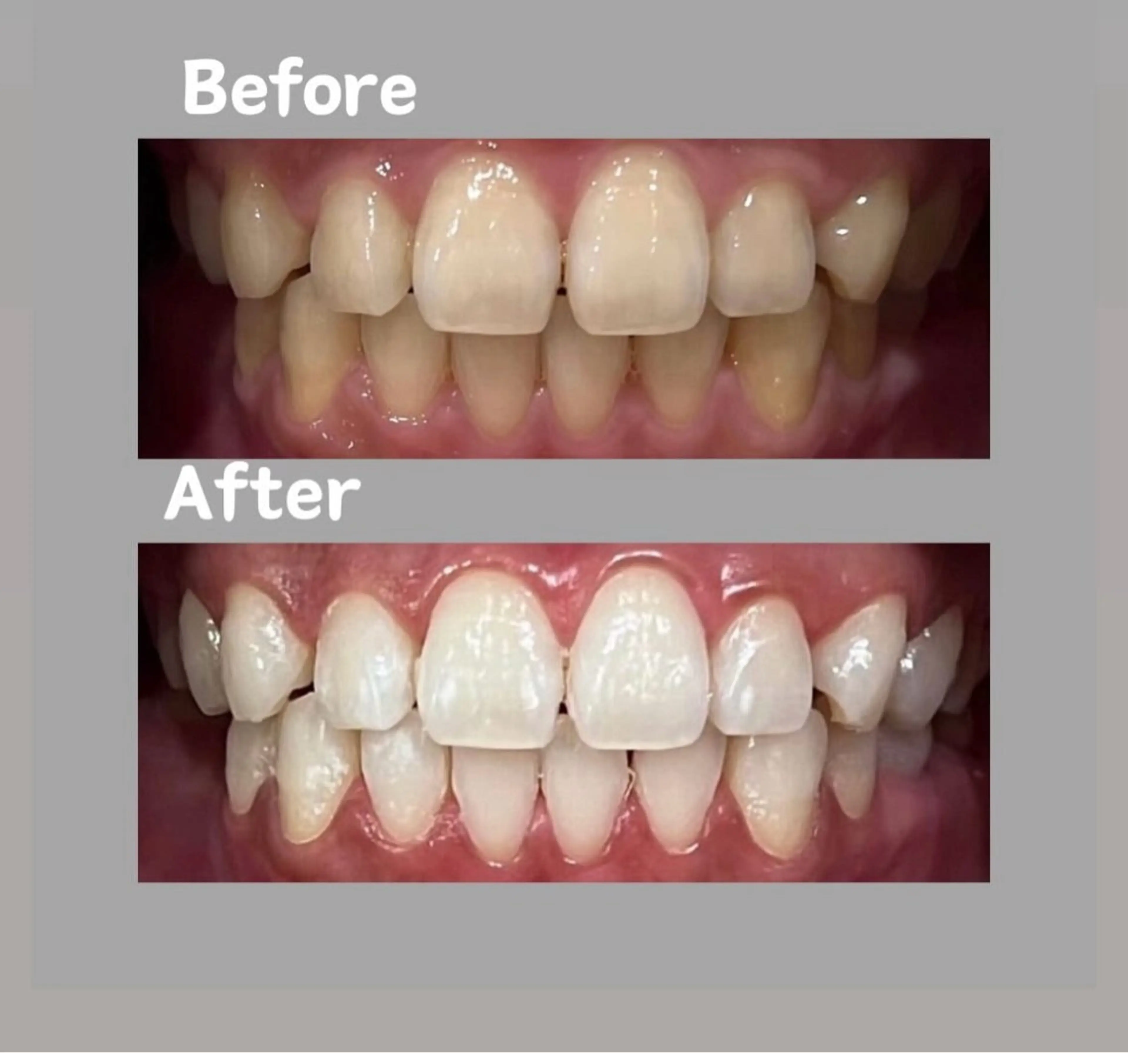 Kaula所属・Kaula ホワイトニング耳ツボのその他イメージ