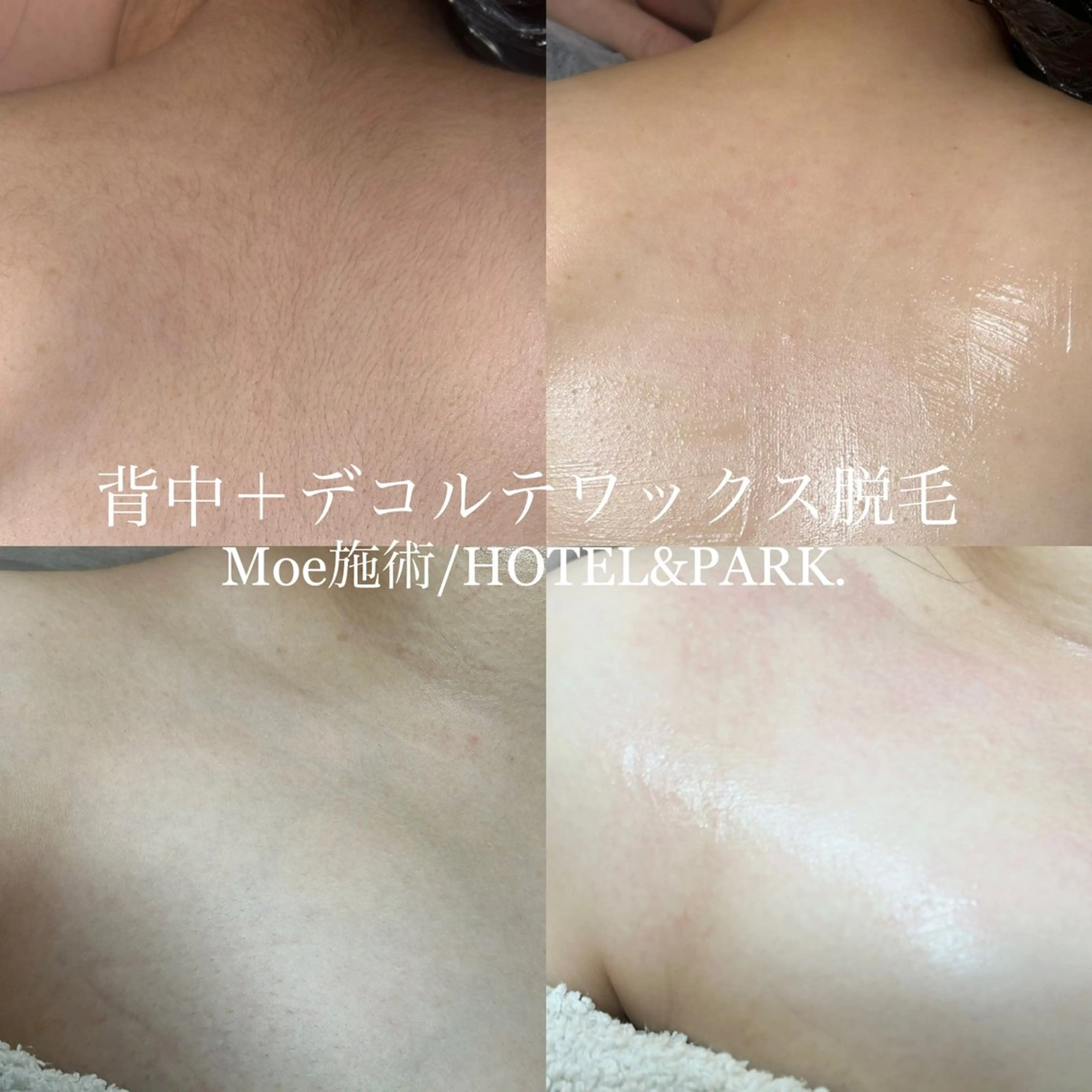 HOTEL&PARK .Moeワックス脱毛のエステ・リラクイメージ