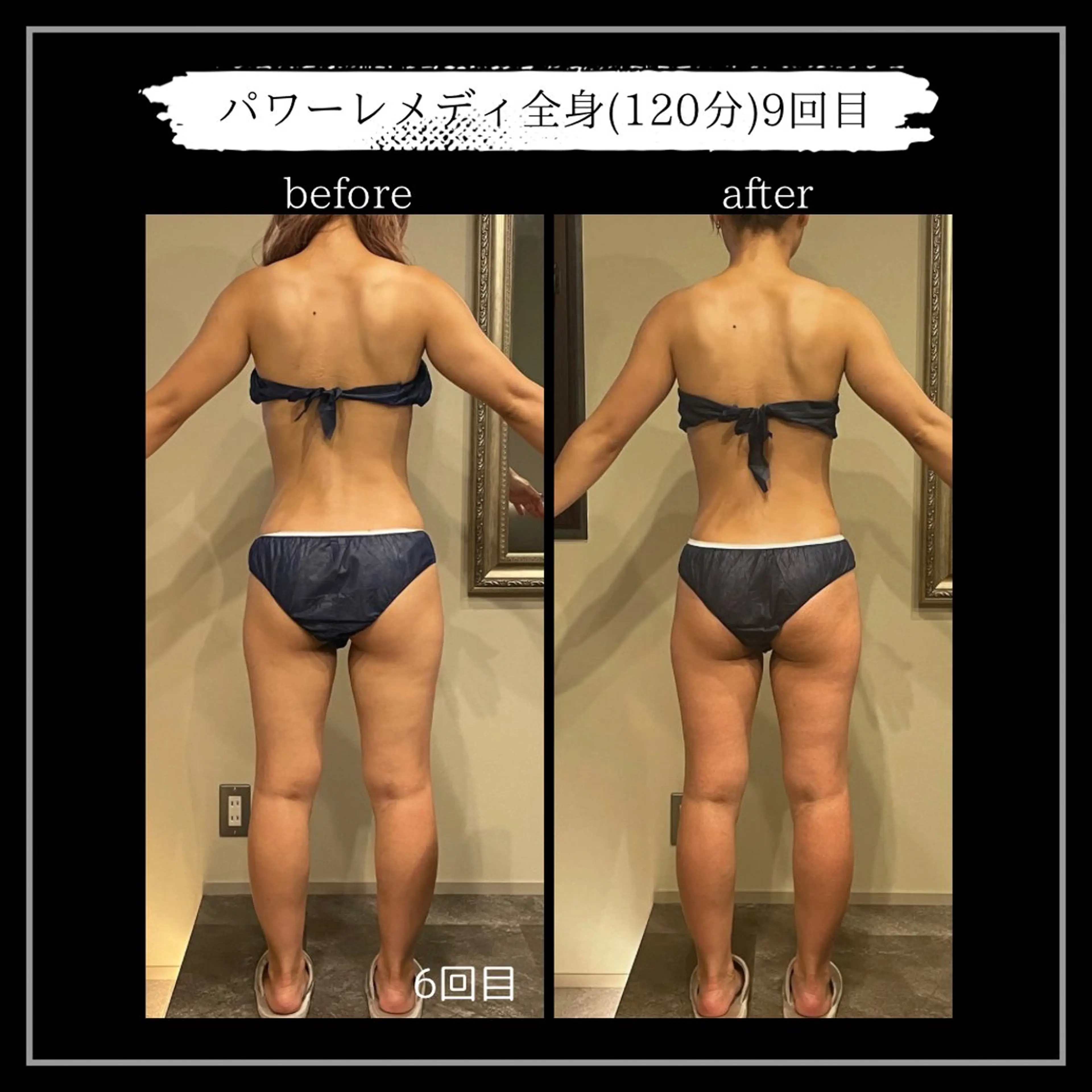 オフ:オン所属・オフ:オン 全身筋膜マッサージのエステ・リラクイメージ