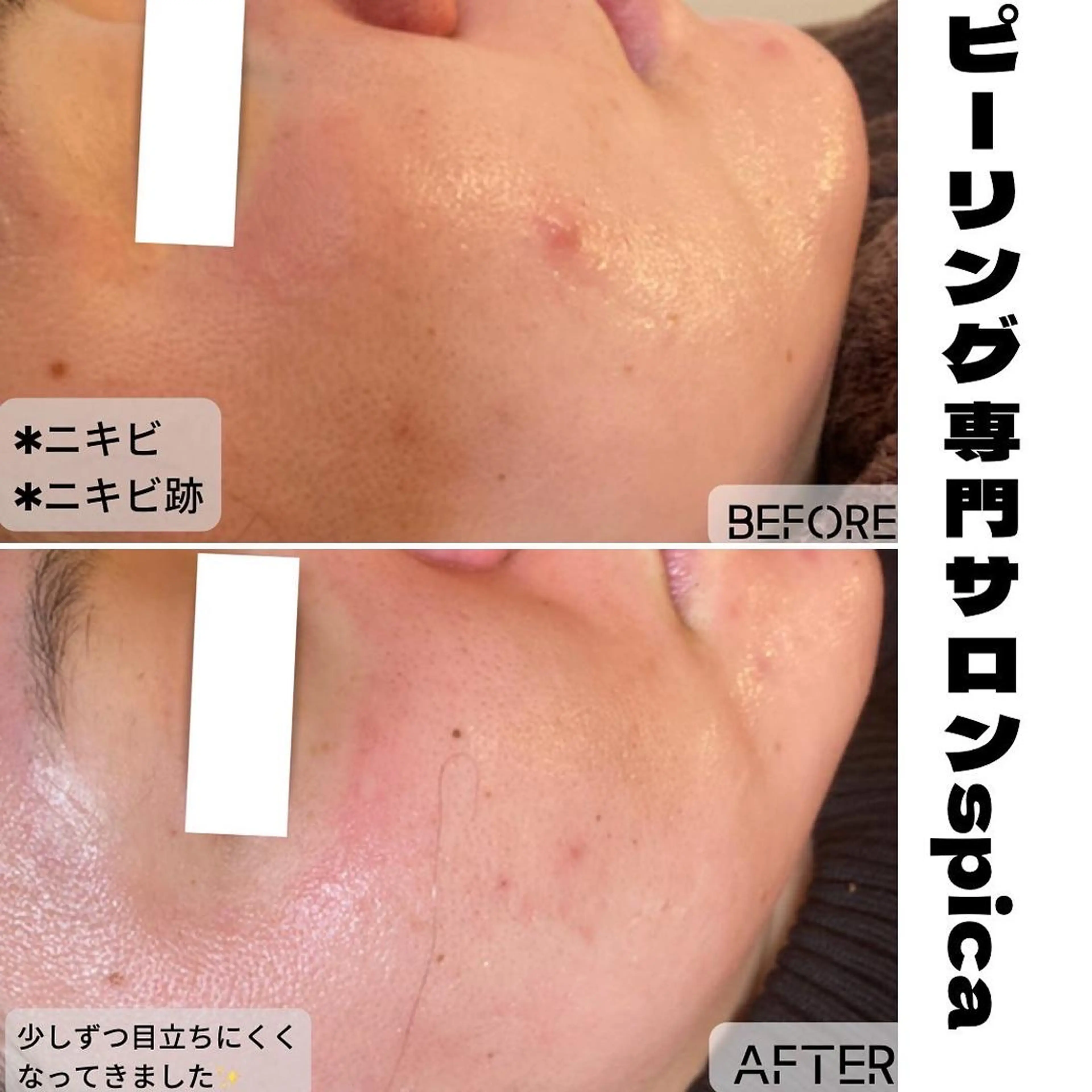 エステ ピーリング専門サロン Spicaのエステ・リラクイメージ