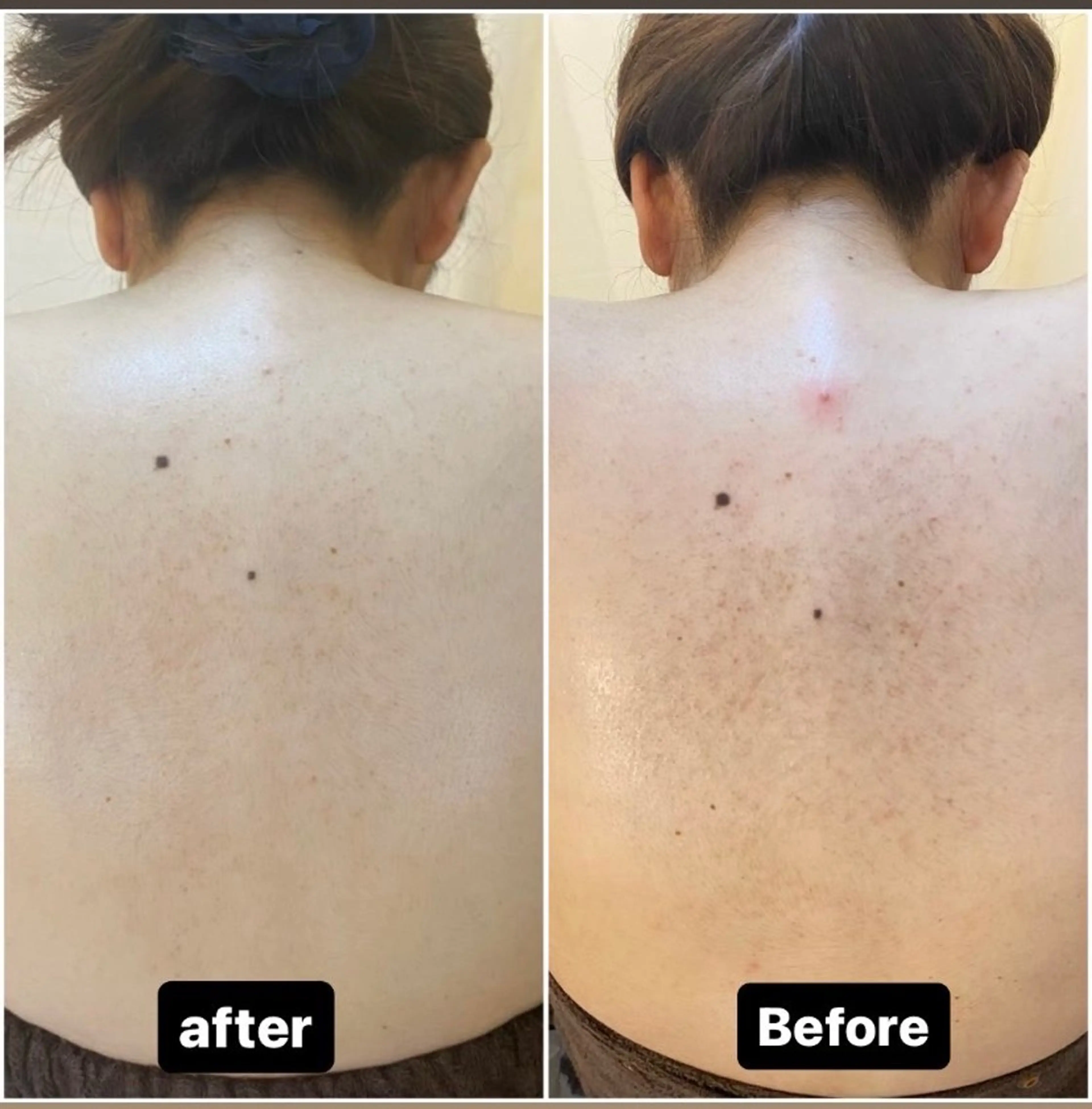 エステ リラク BELCIA福岡店　récolte de BELCIA（レコルトデベルシア）所属・BELCIA福岡店 レコルトデベルシアのエステ・リラクイメージ