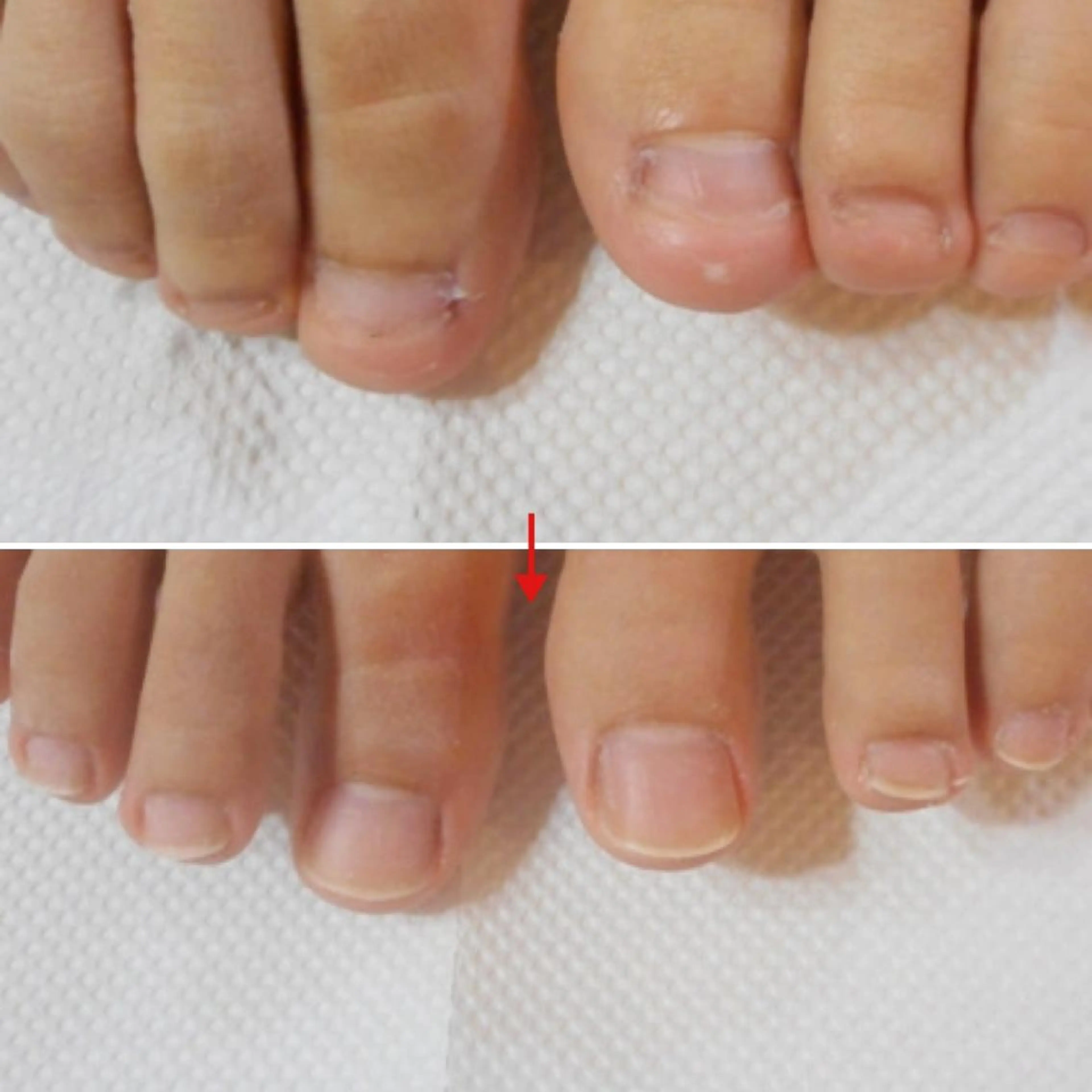 ネイル フットネイル フットネイル ネイルサロンアリューム所属・ネイルサロン アリュームのネイルデザイン